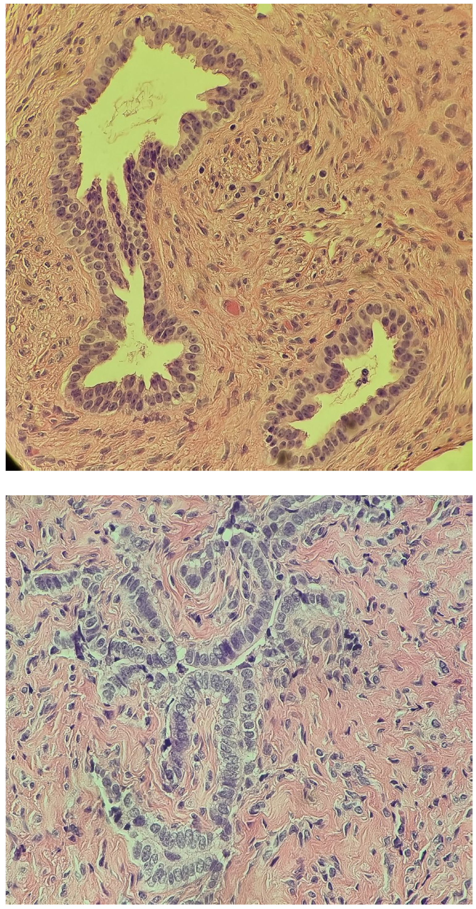 Diagnostics 14 02621 g003b Diagnostics 14 02621 g003b