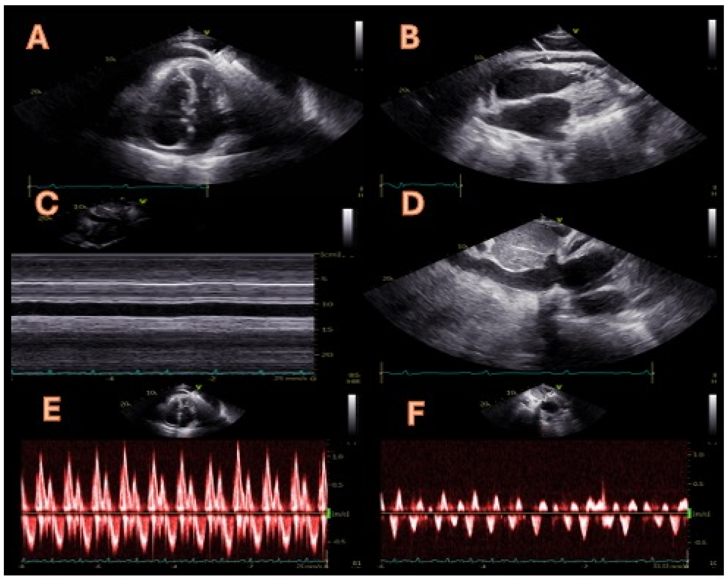 Diagnostics 14 02642 g001