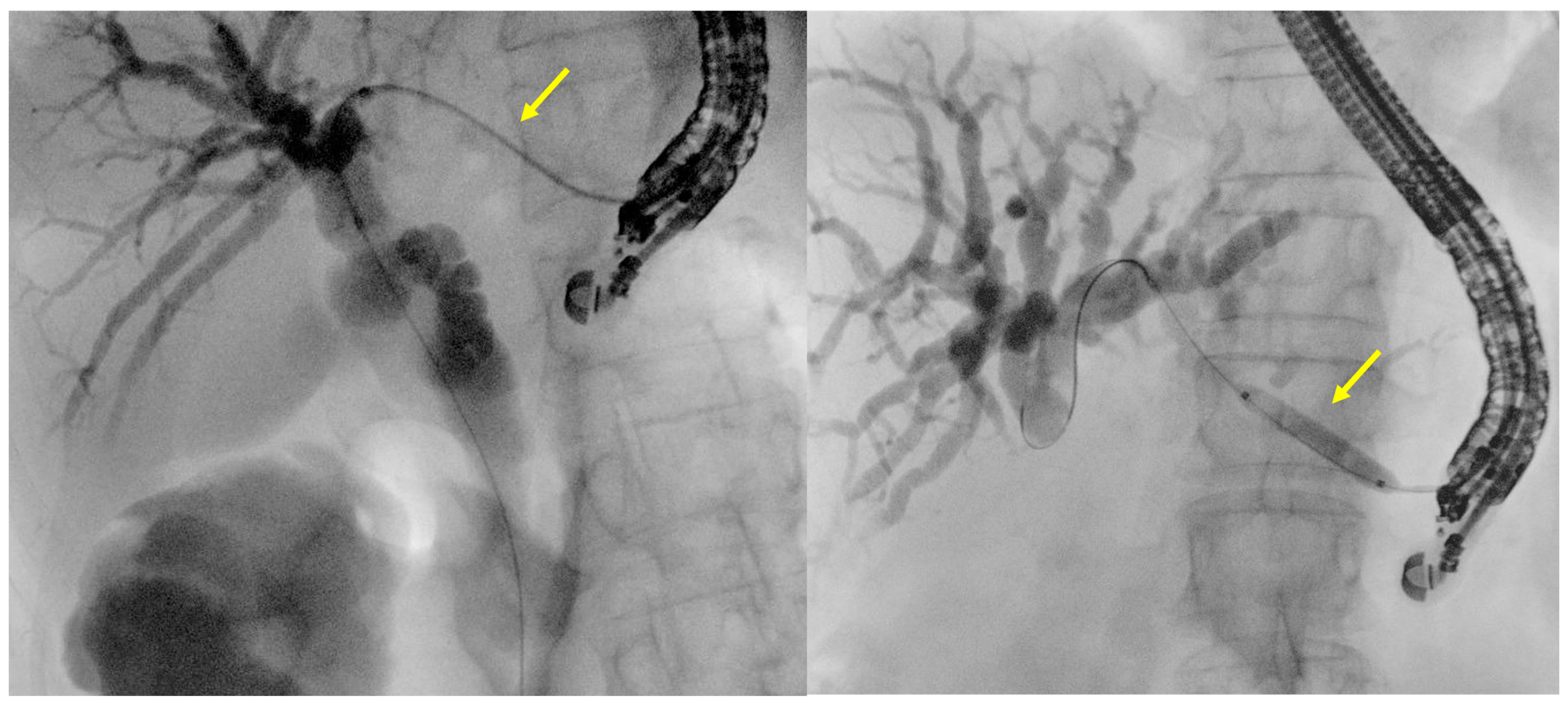 Diagnostics 14 02644 g003 Diagnostics 14 02644 g003