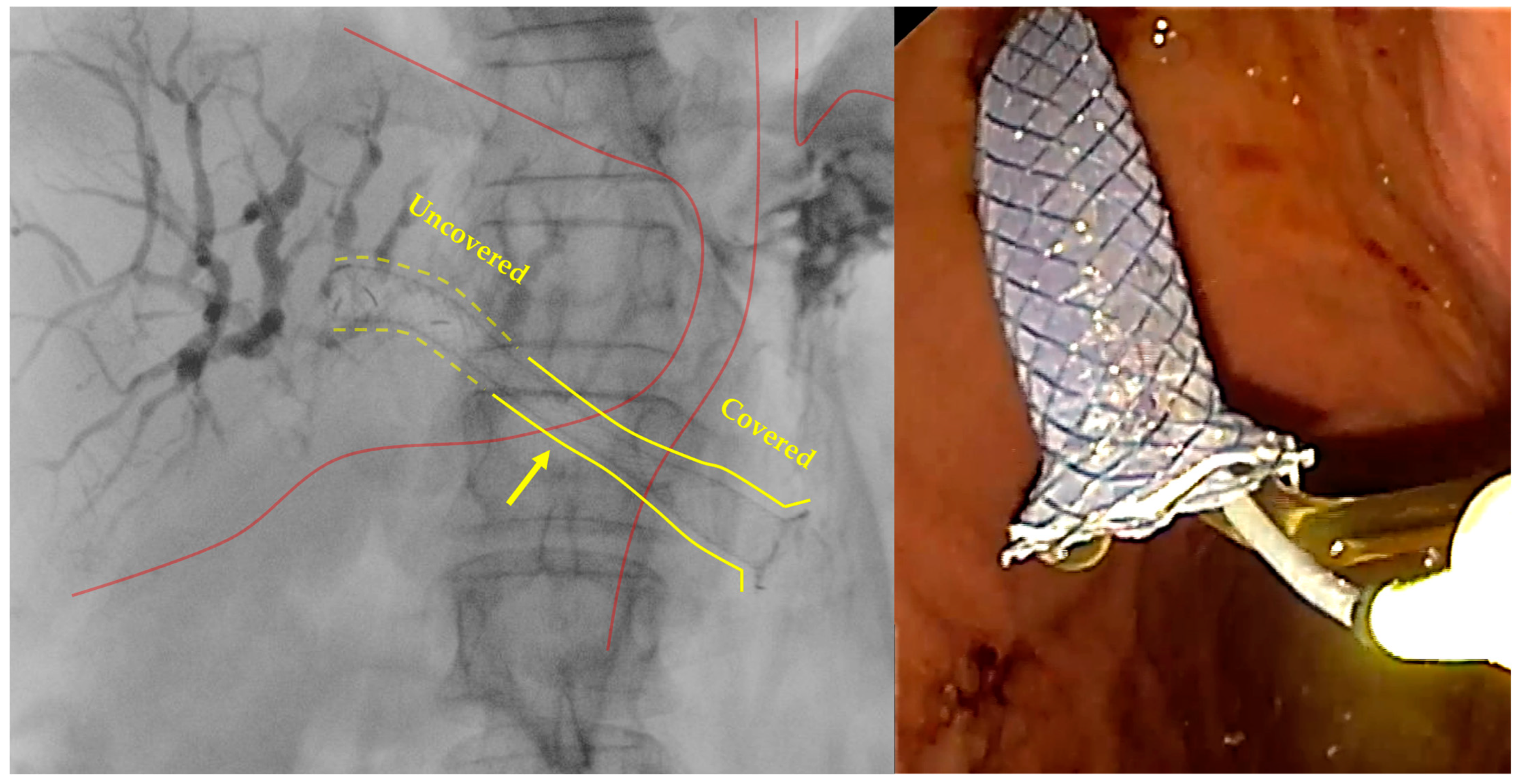 Diagnostics 14 02644 g004 Diagnostics 14 02644 g004