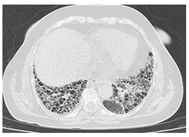 Diagnostics 14 02674 i004