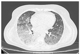 Diagnostics 14 02674 i005