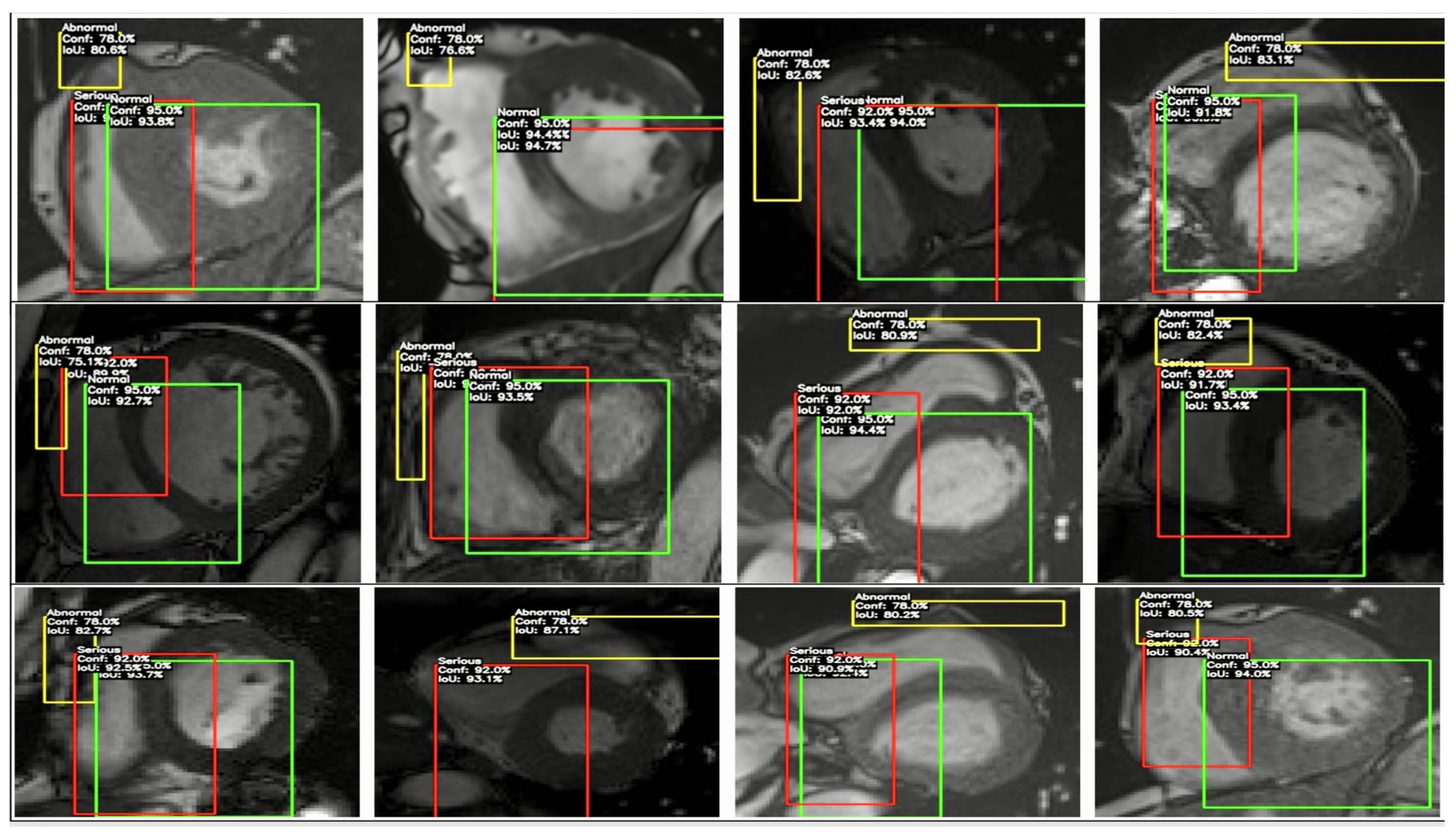 Diagnostics 14 02675 g013