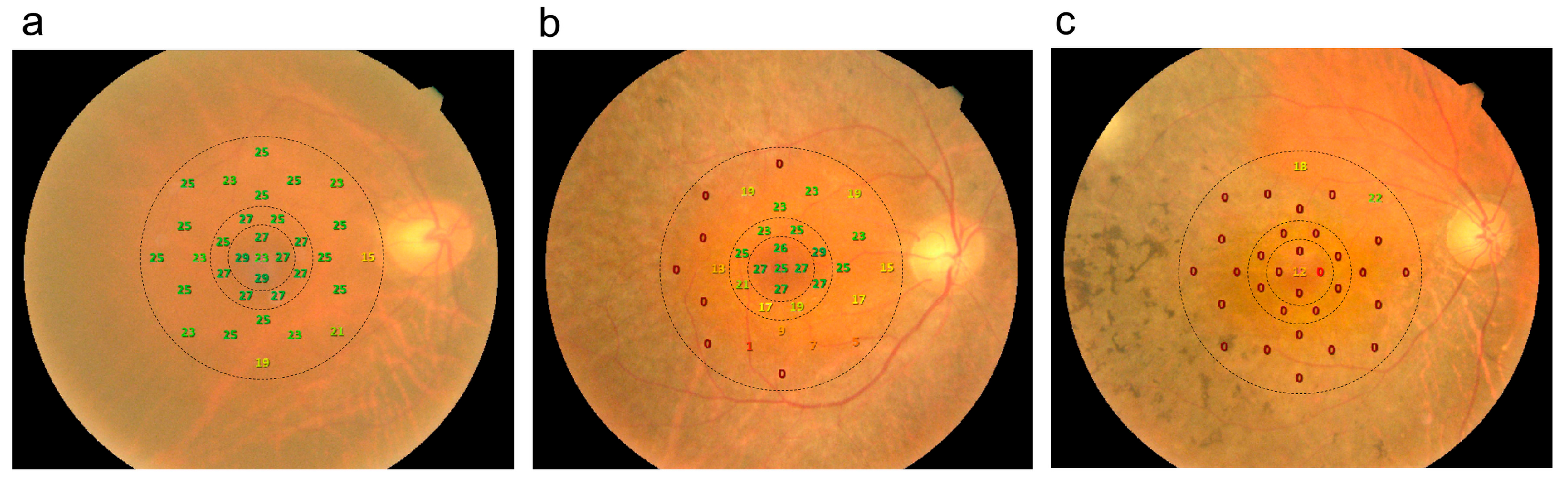 Diagnostics 14 02691 g001 Diagnostics 14 02691 g001