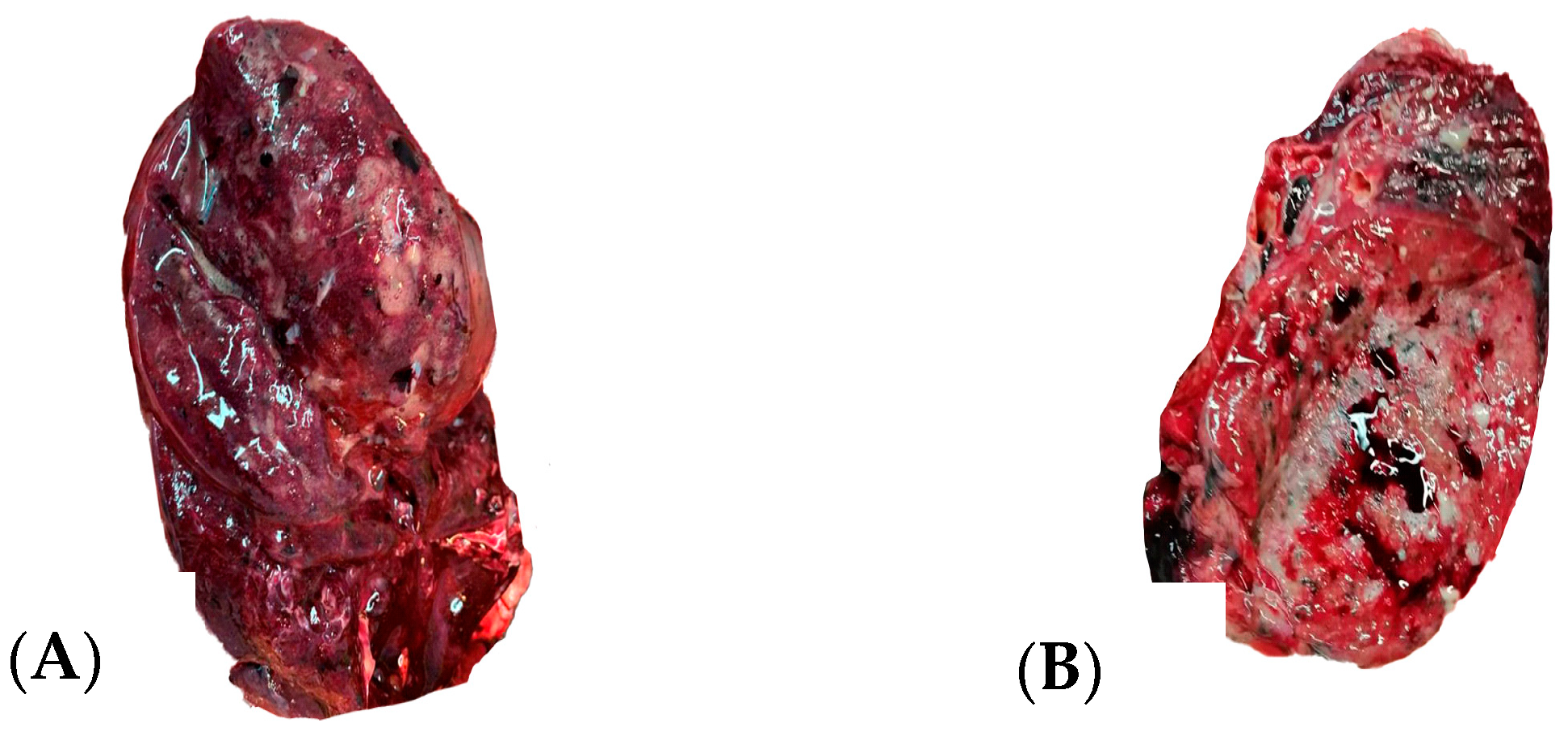 Diagnostics 14 02737 g003