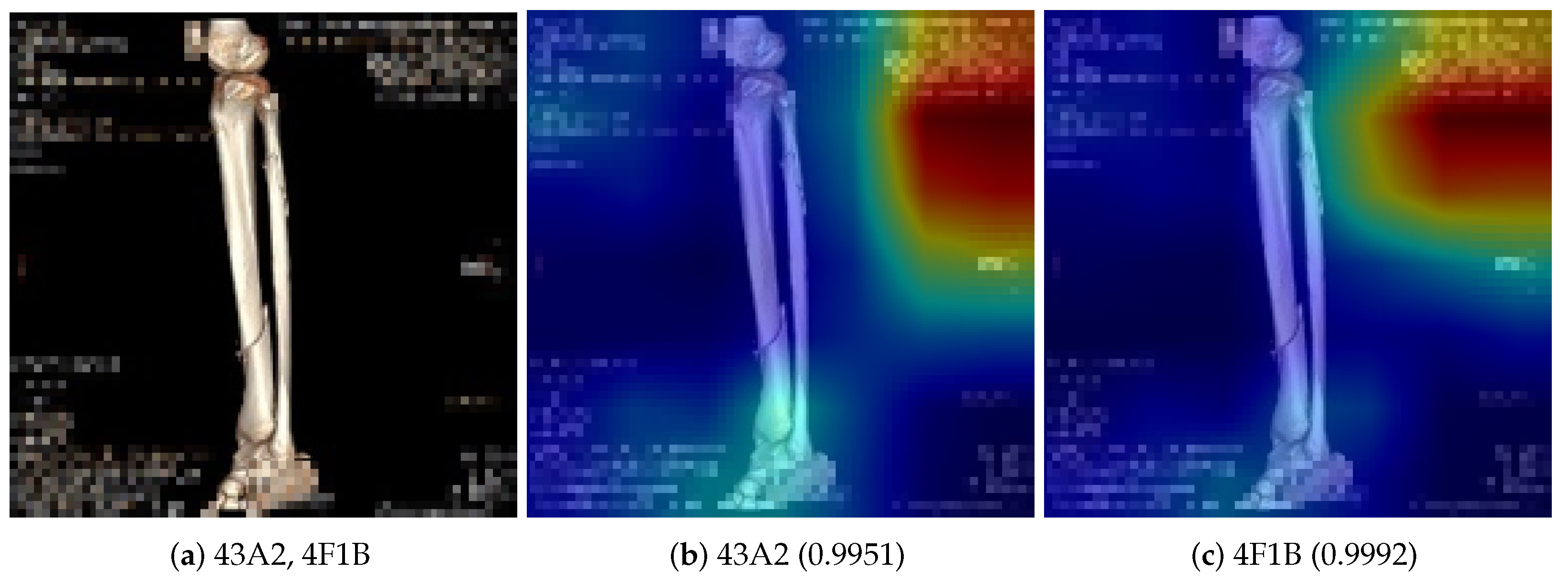 Diagnostics 14 02740 g001