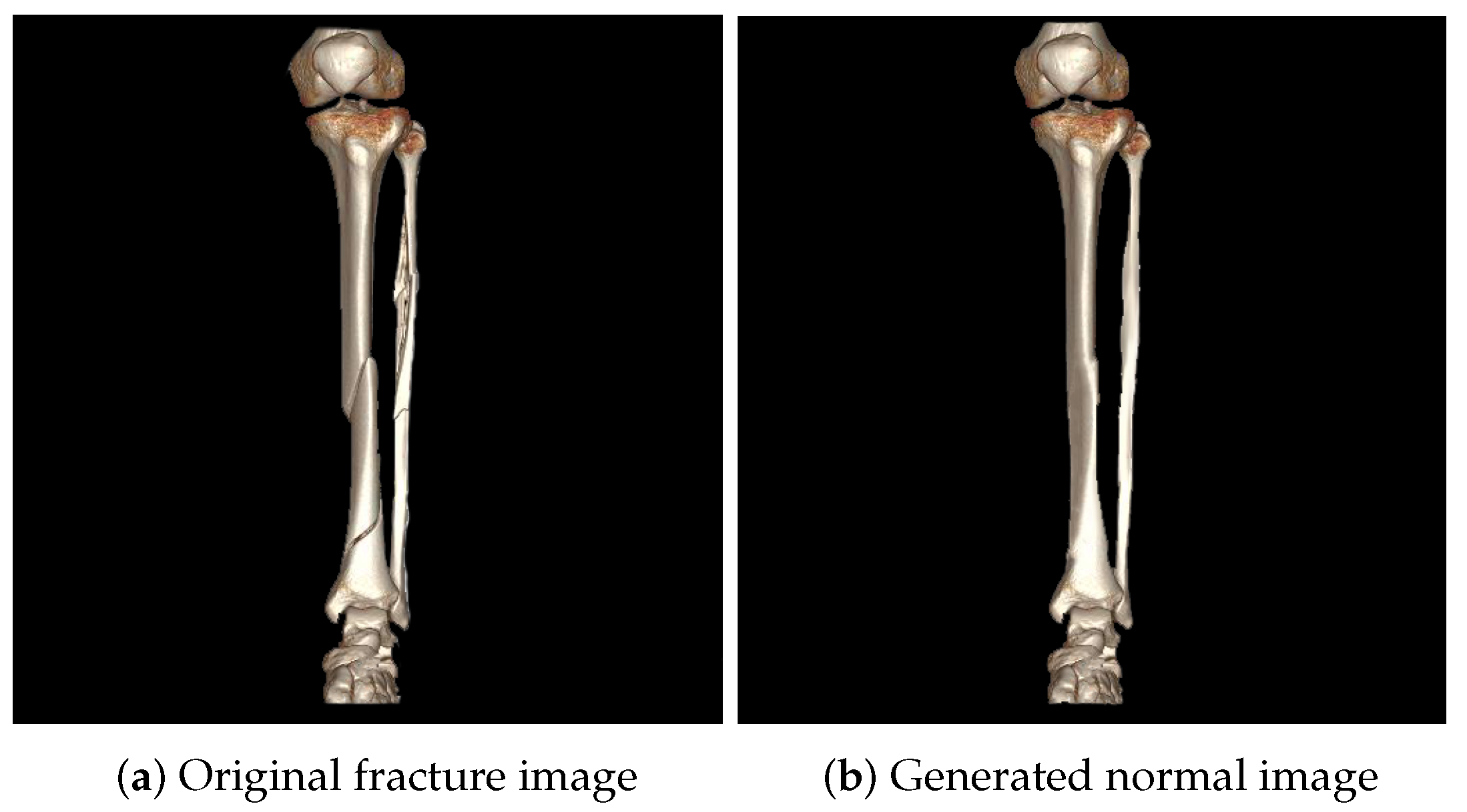 Diagnostics 14 02740 g002