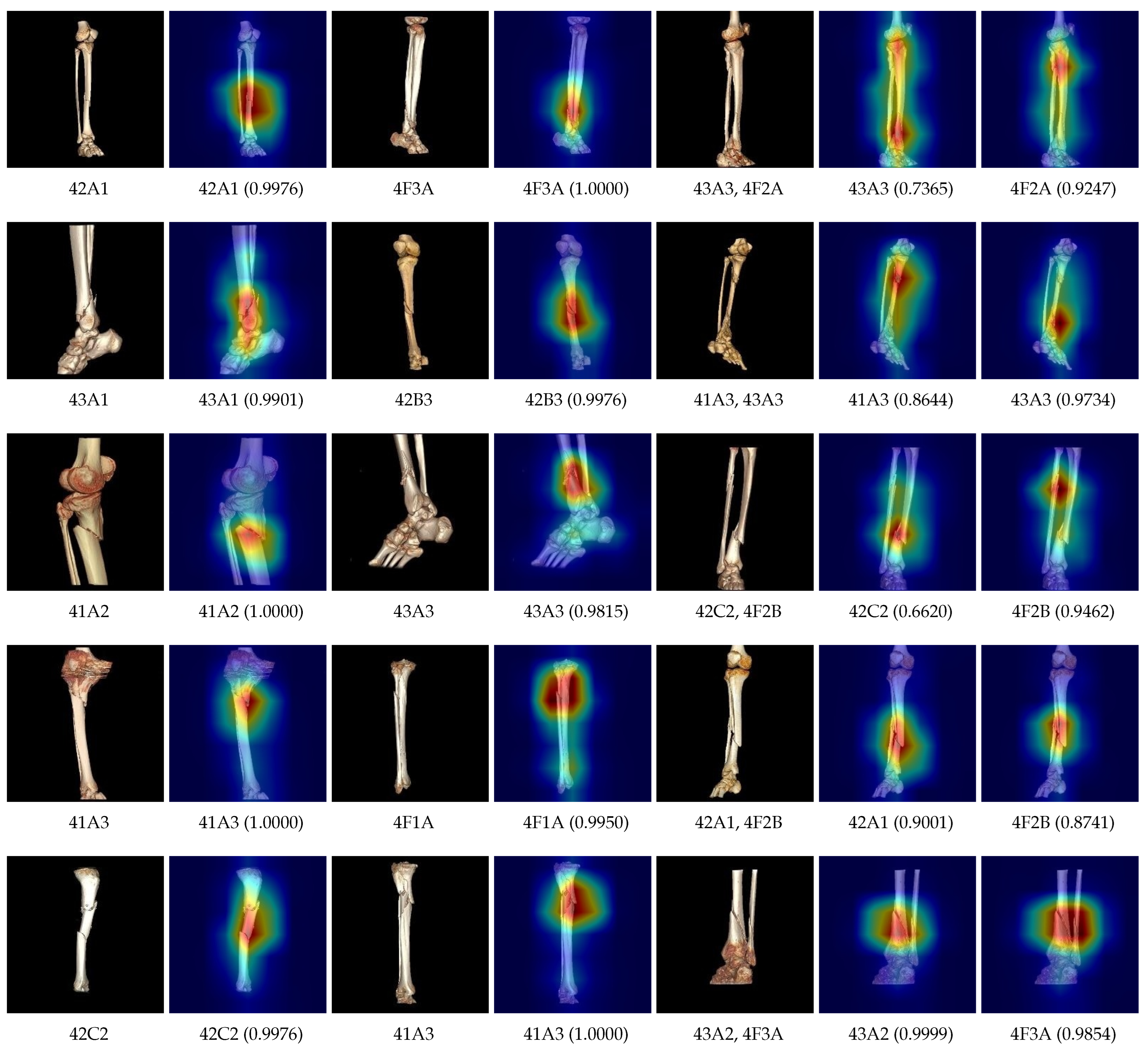 Diagnostics 14 02740 g009