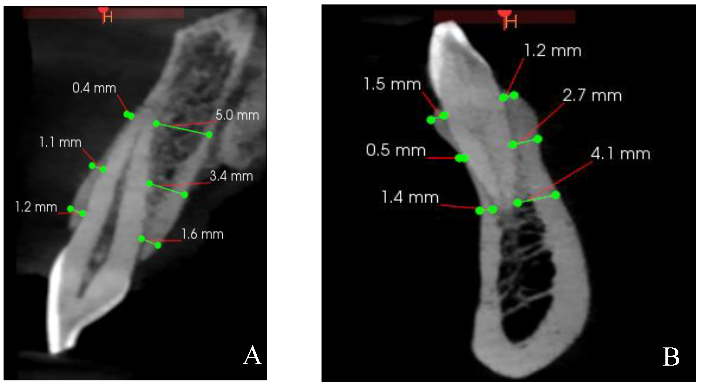 Diagnostics 14 02756 g004