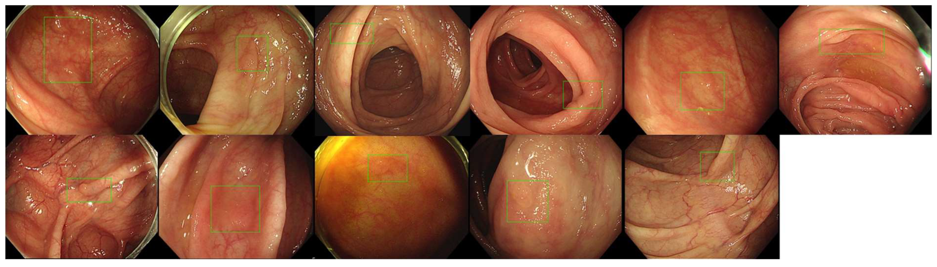 Diagnostics 14 02762 g005