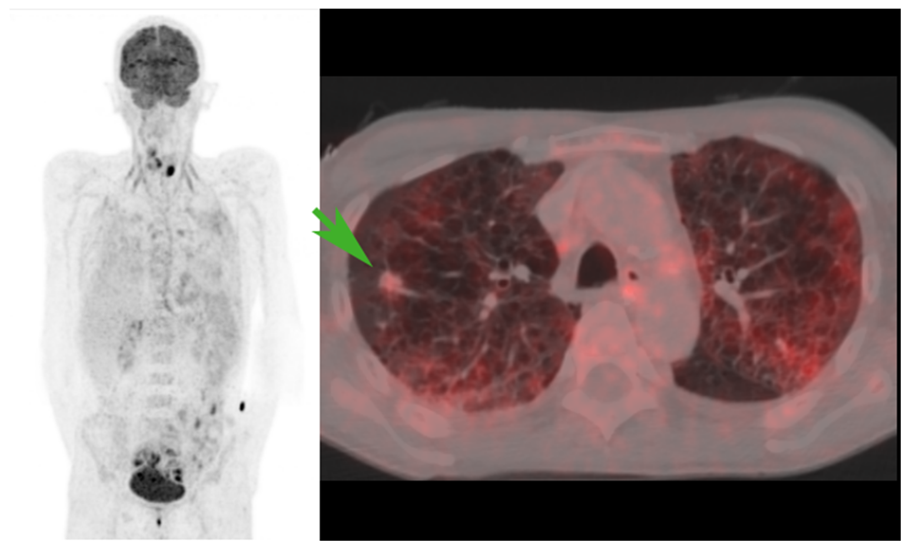 Diagnostics 14 02764 g003