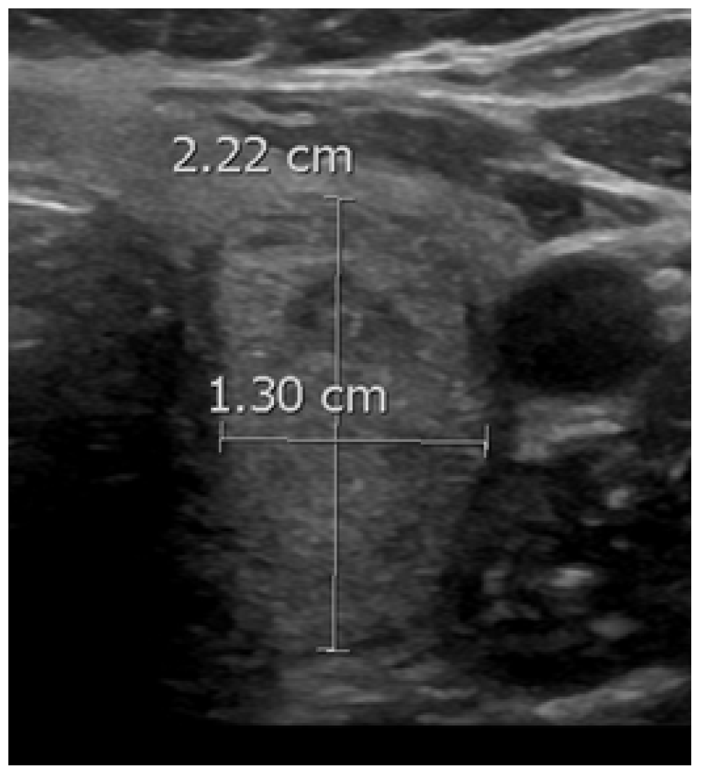 Diagnostics 14 02775 g003