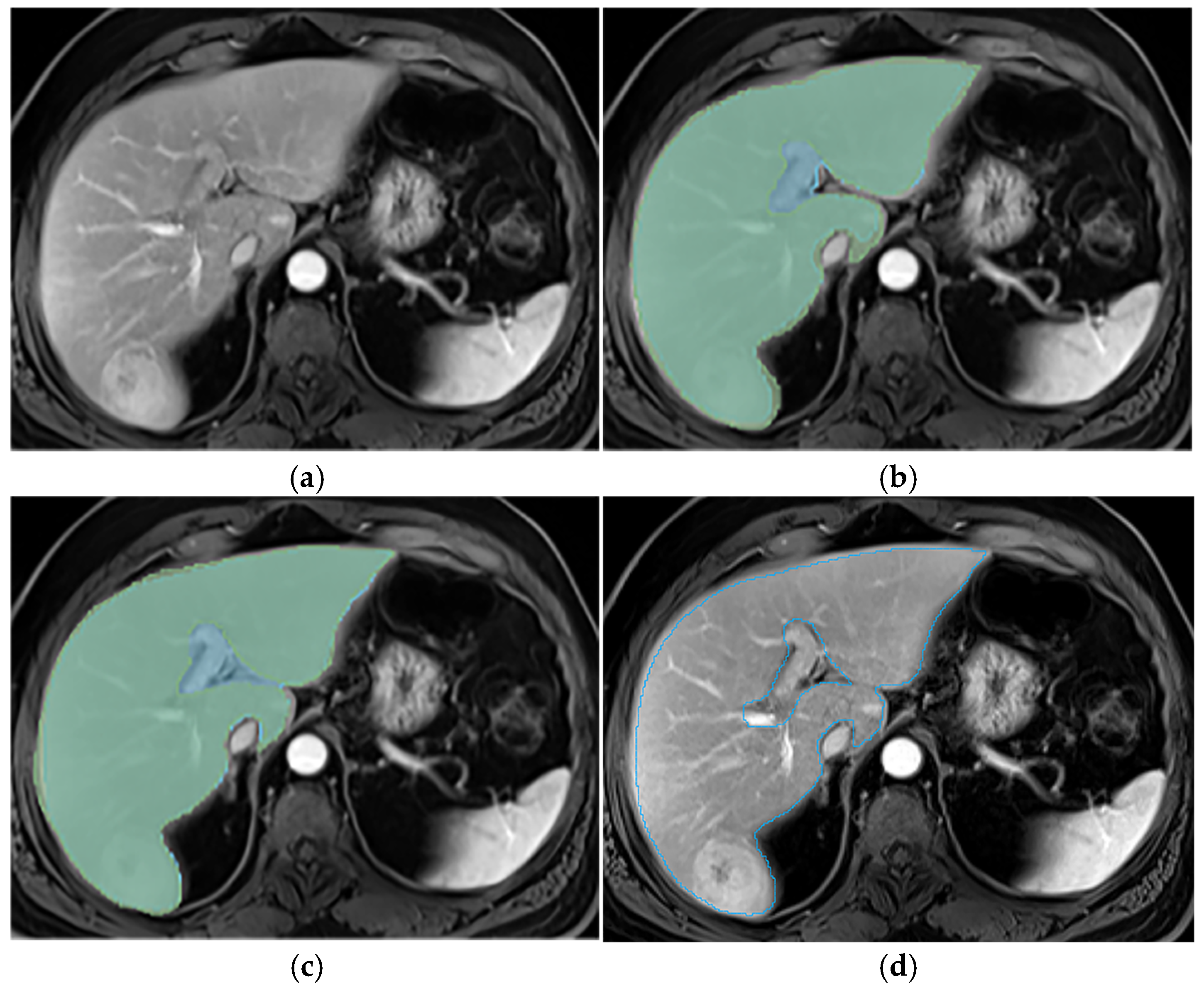 Diagnostics 14 02785 g004