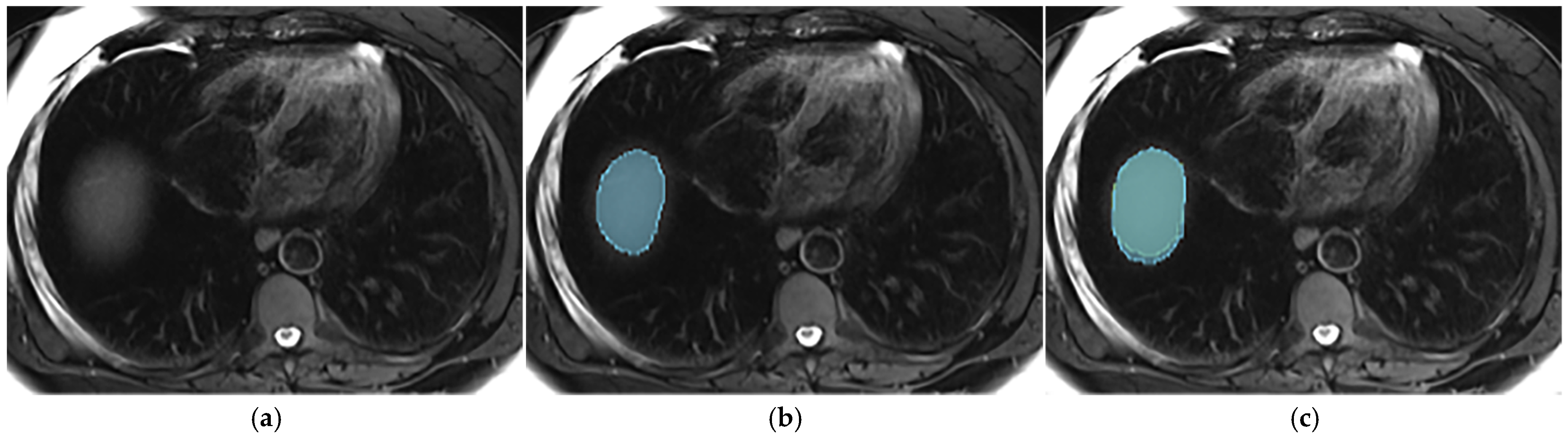Diagnostics 14 02785 g005