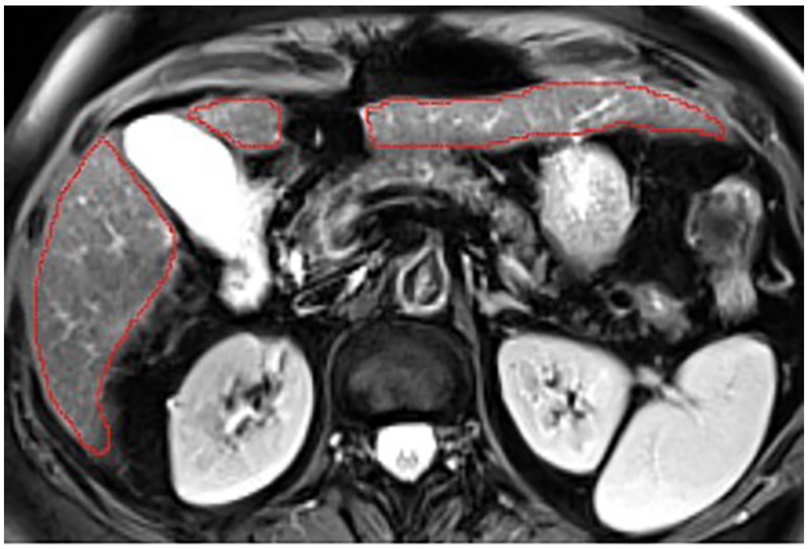 Diagnostics 14 02785 g0a10