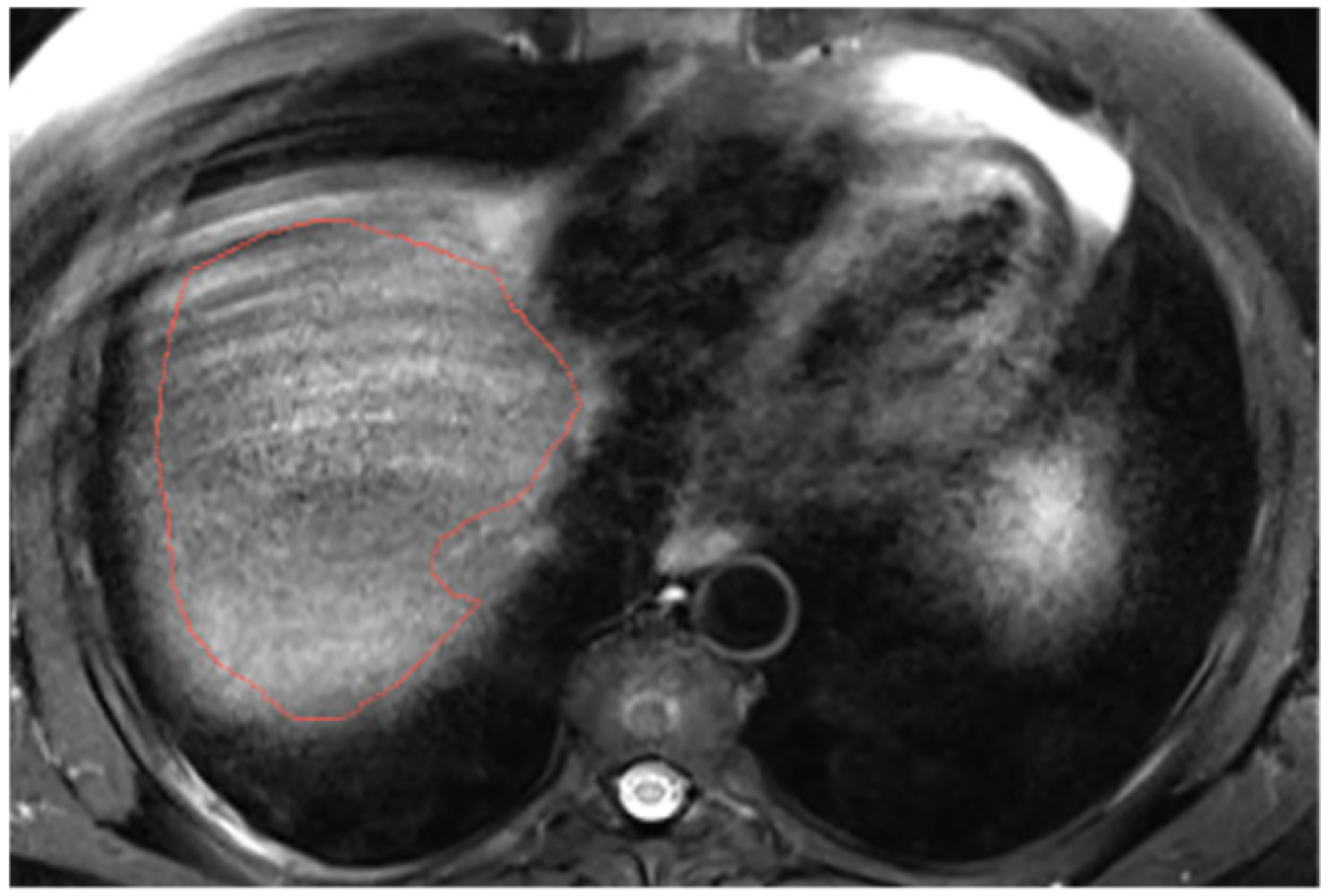 Diagnostics 14 02785 g0a11
