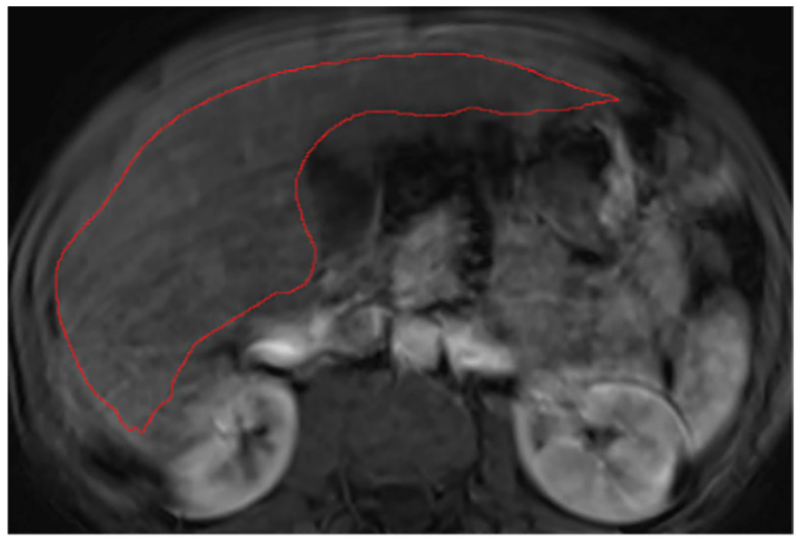 Diagnostics 14 02785 g0a12