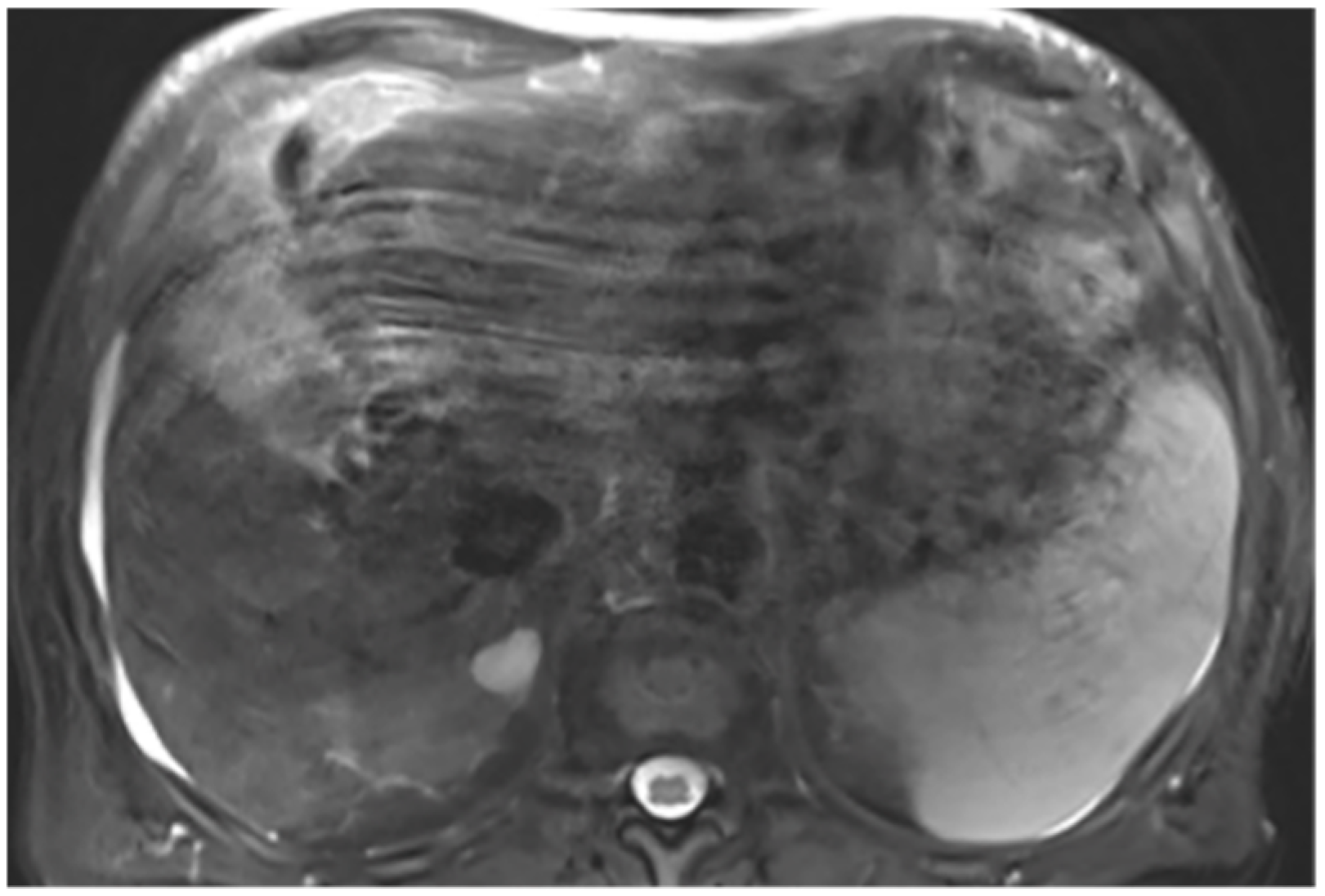 Diagnostics 14 02785 g0a13