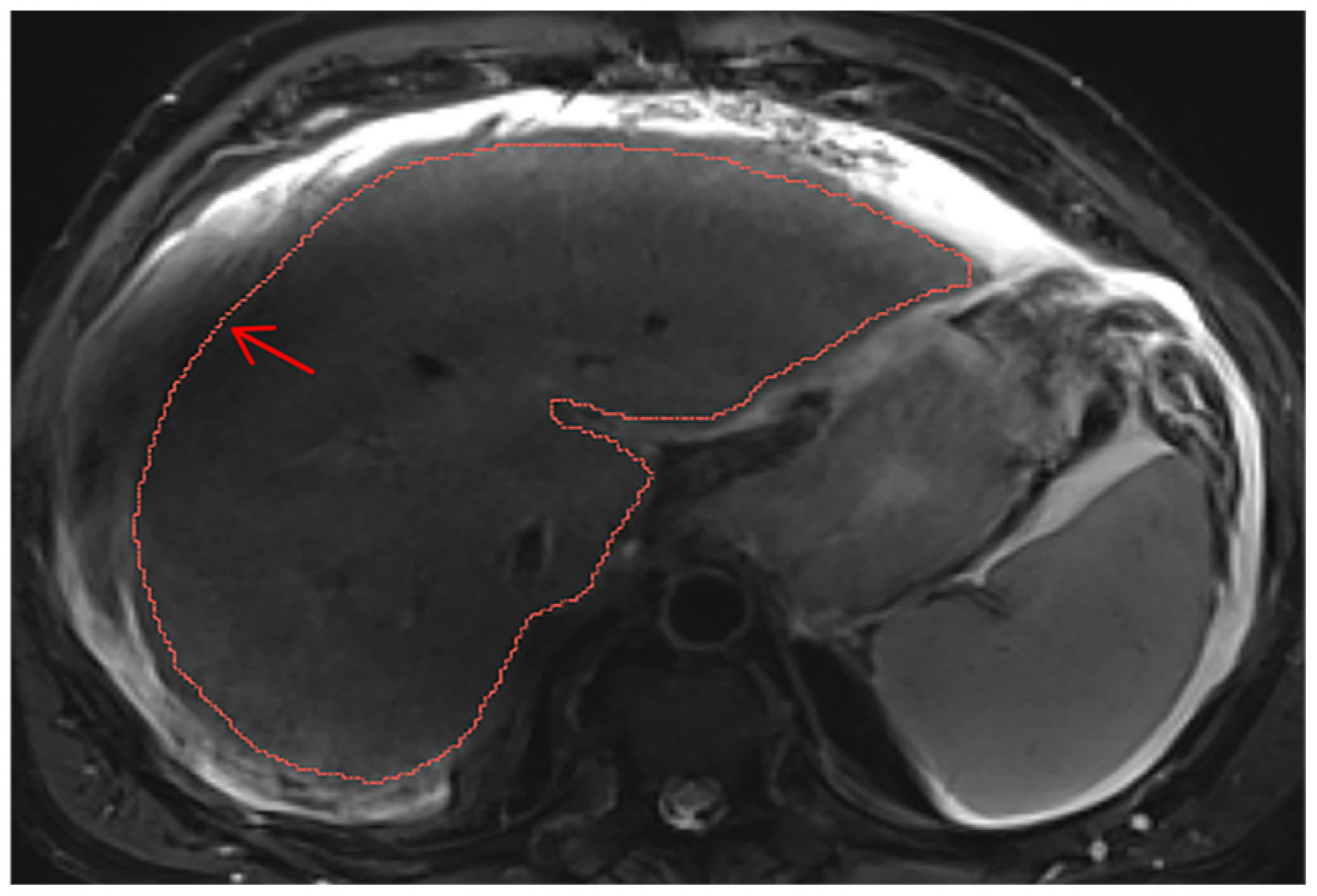 Diagnostics 14 02785 g0a15