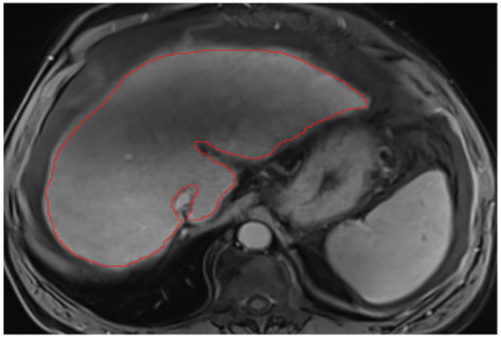 Diagnostics 14 02785 g0a16