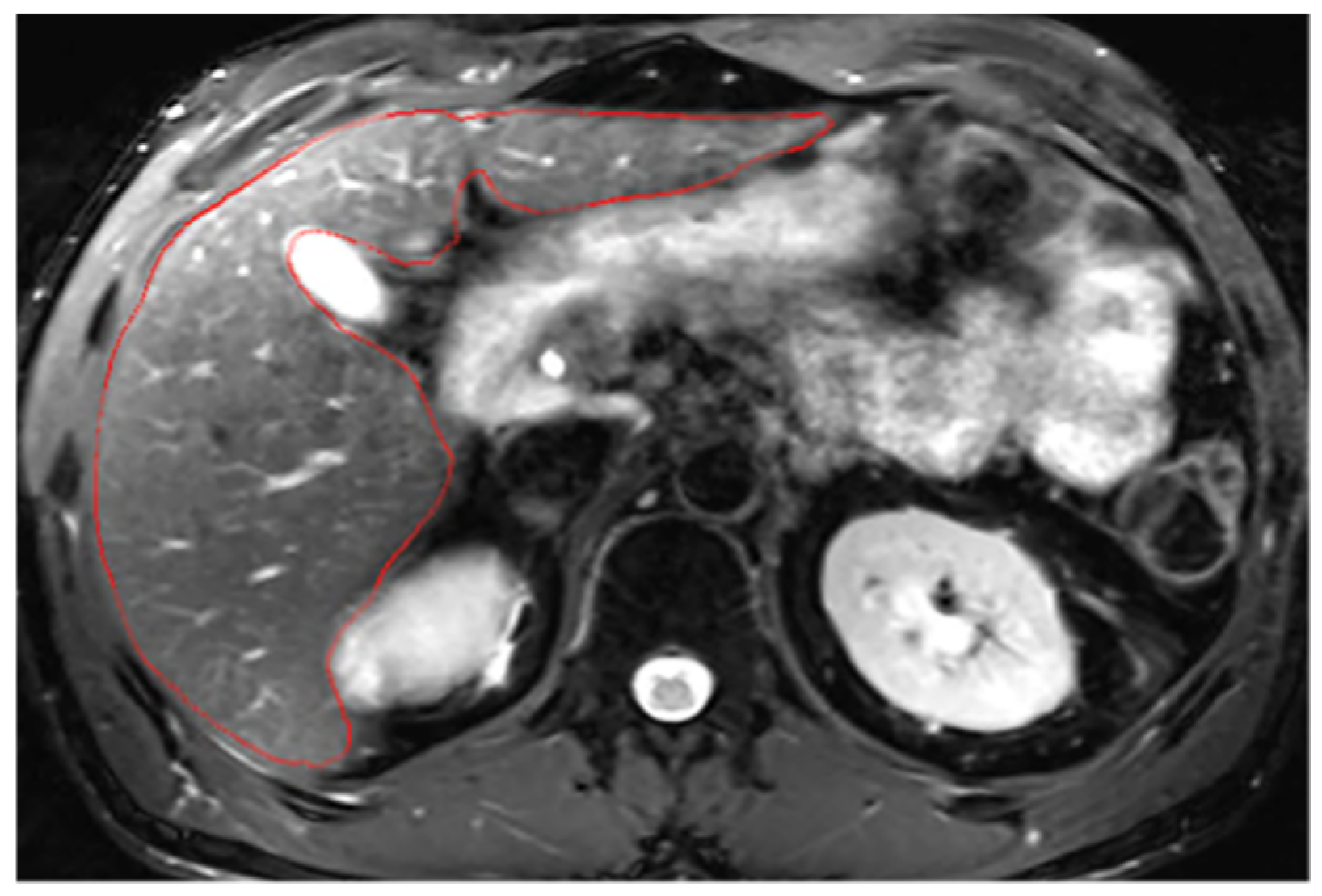 Diagnostics 14 02785 g0a2