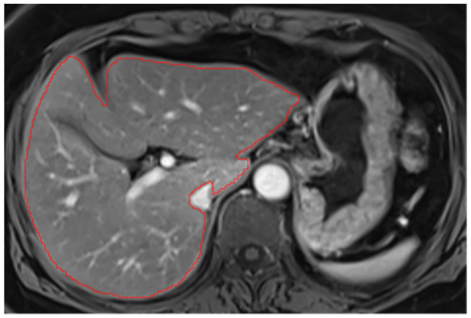 Diagnostics 14 02785 g0a3