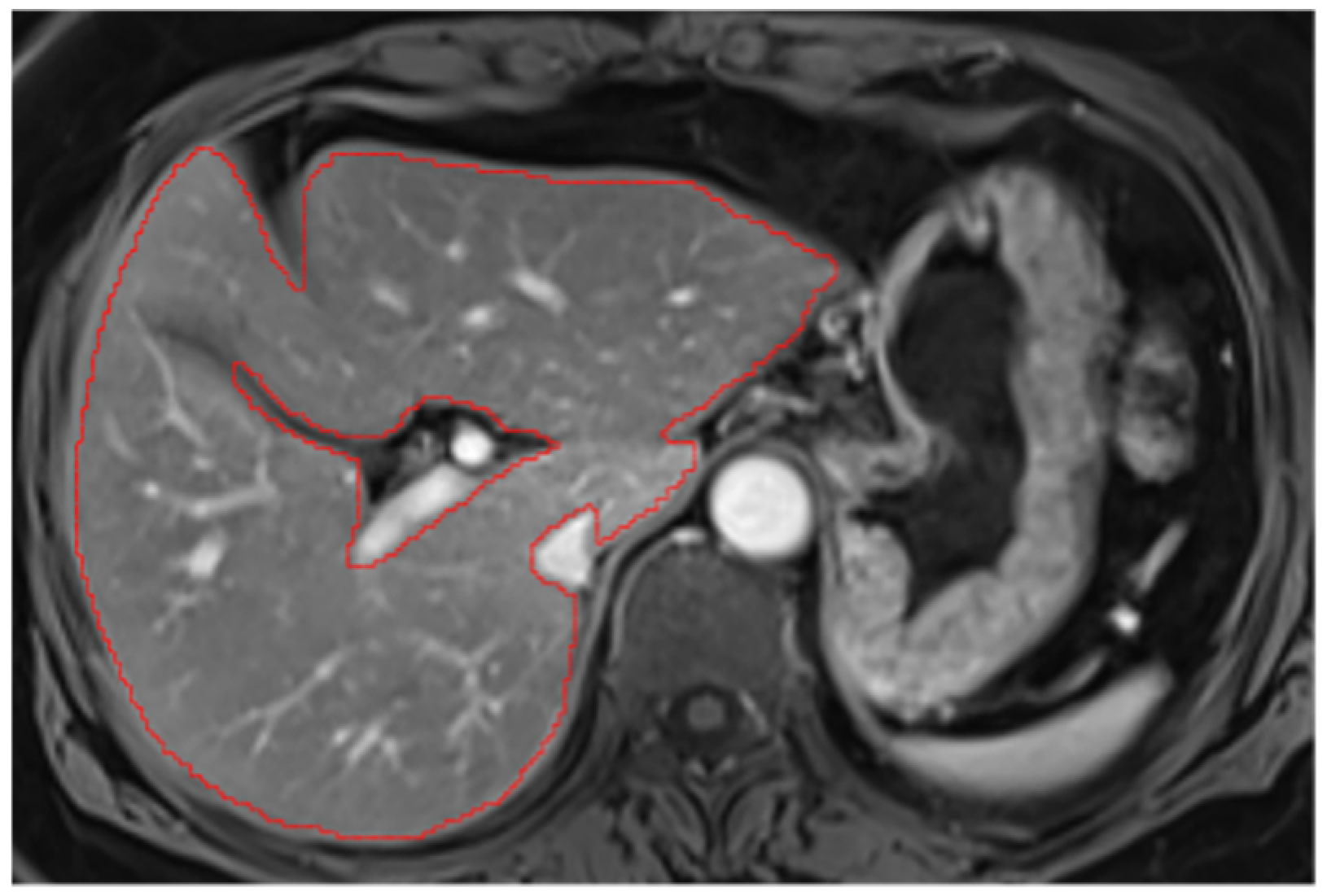 Diagnostics 14 02785 g0a4