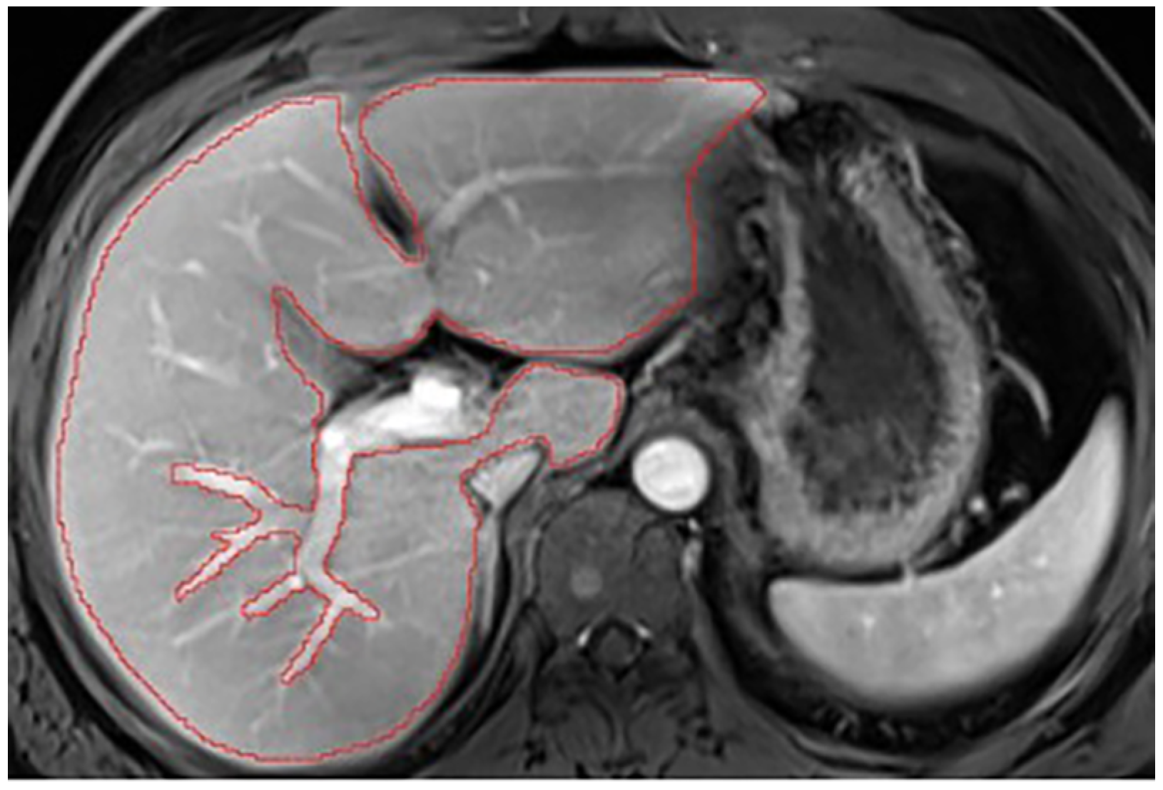 Diagnostics 14 02785 g0a5