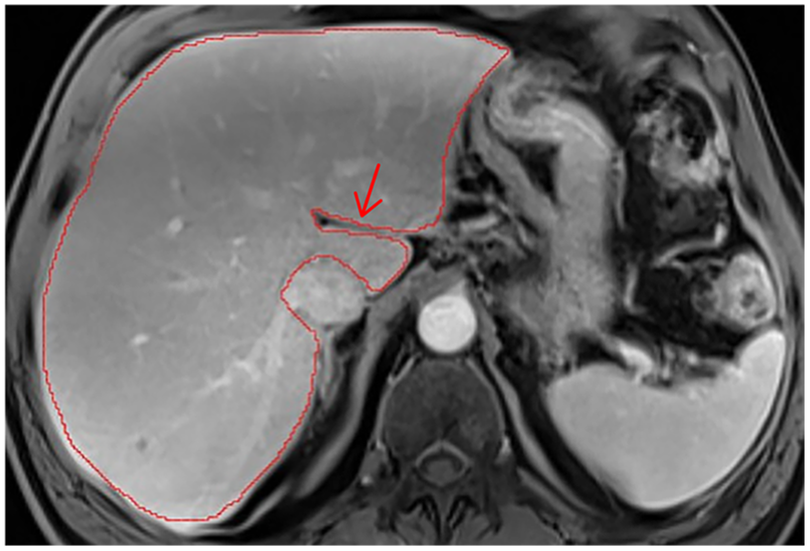 Diagnostics 14 02785 g0a7