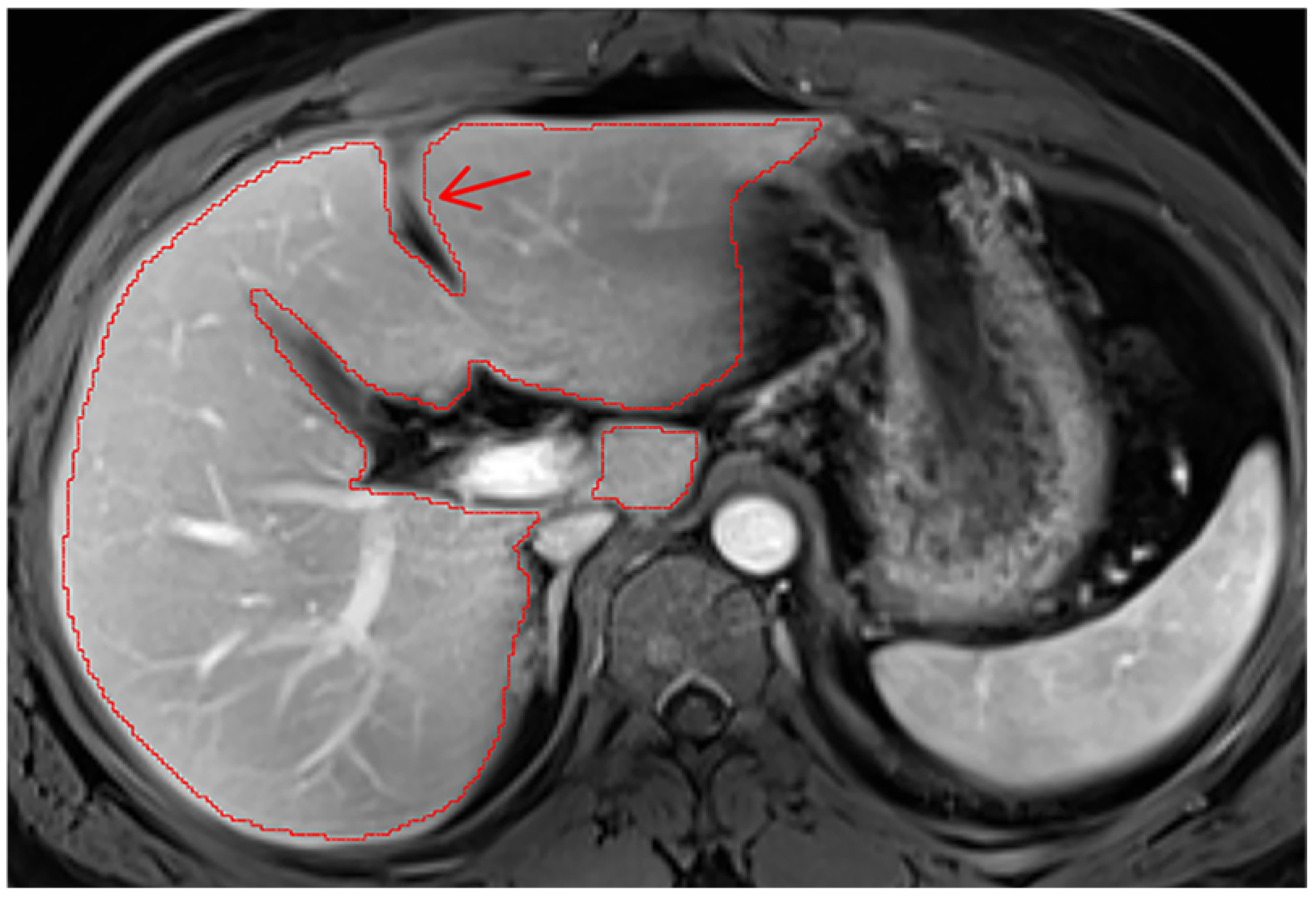 Diagnostics 14 02785 g0a8