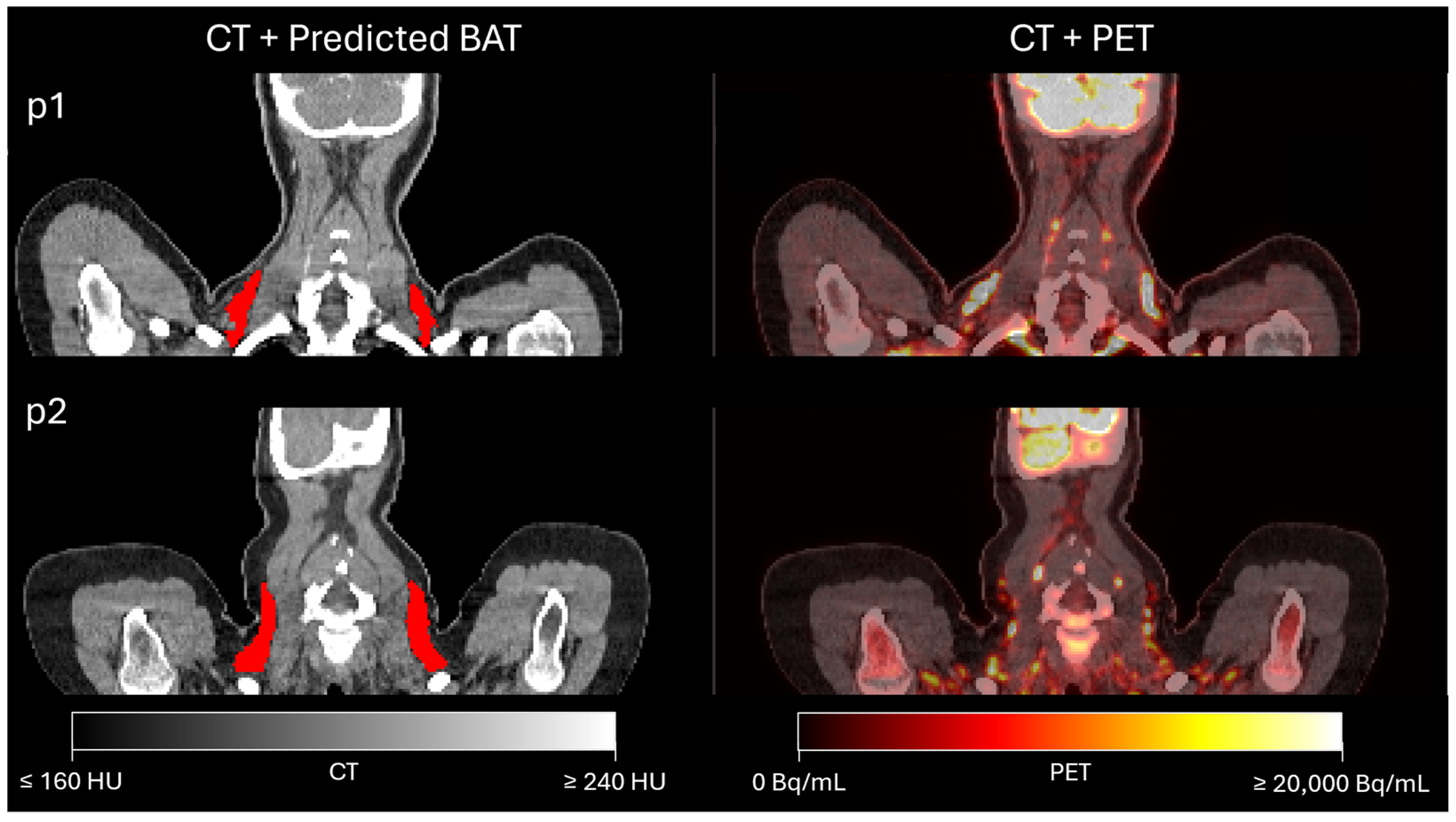 Diagnostics 14 02786 g005 Diagnostics 14 02786 g005