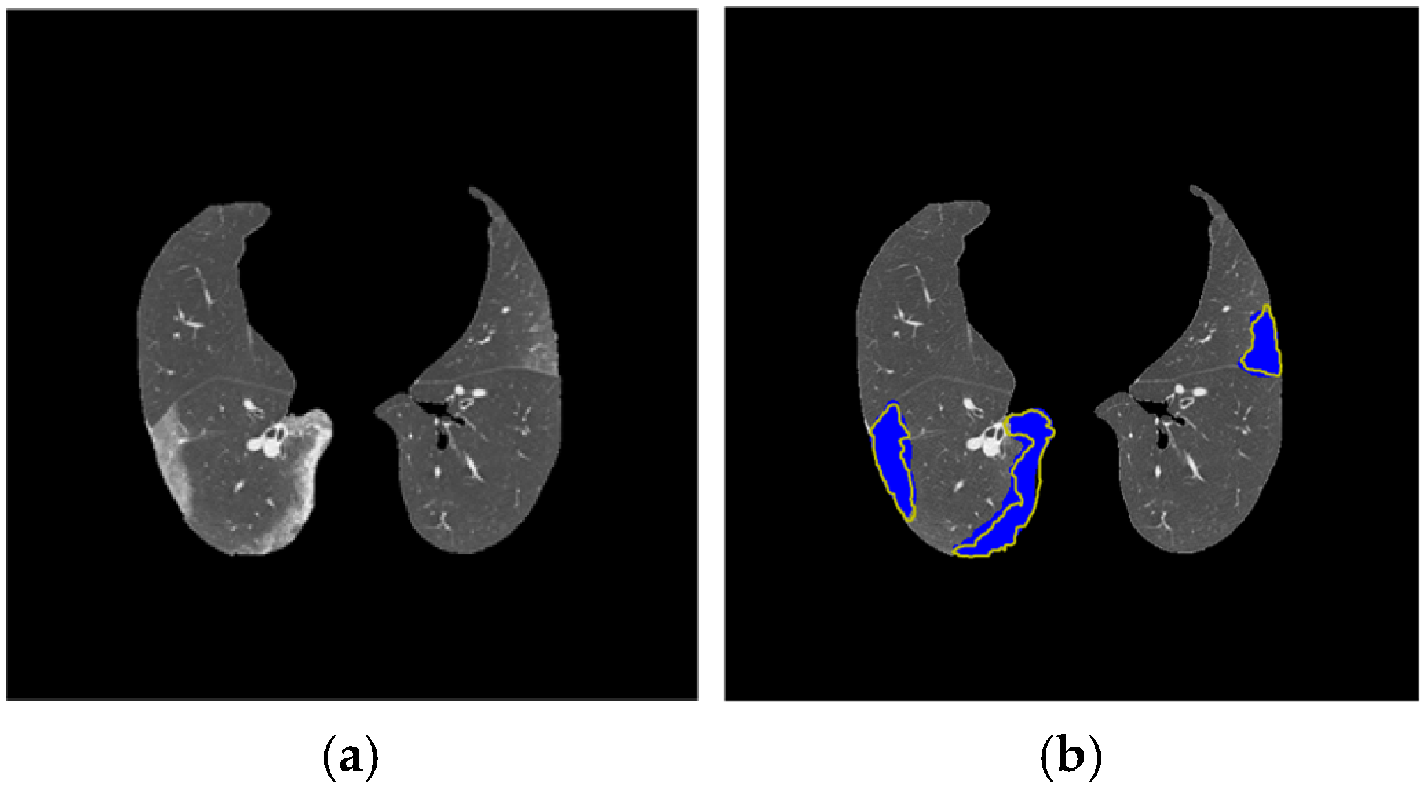 Diagnostics 14 02791 g011