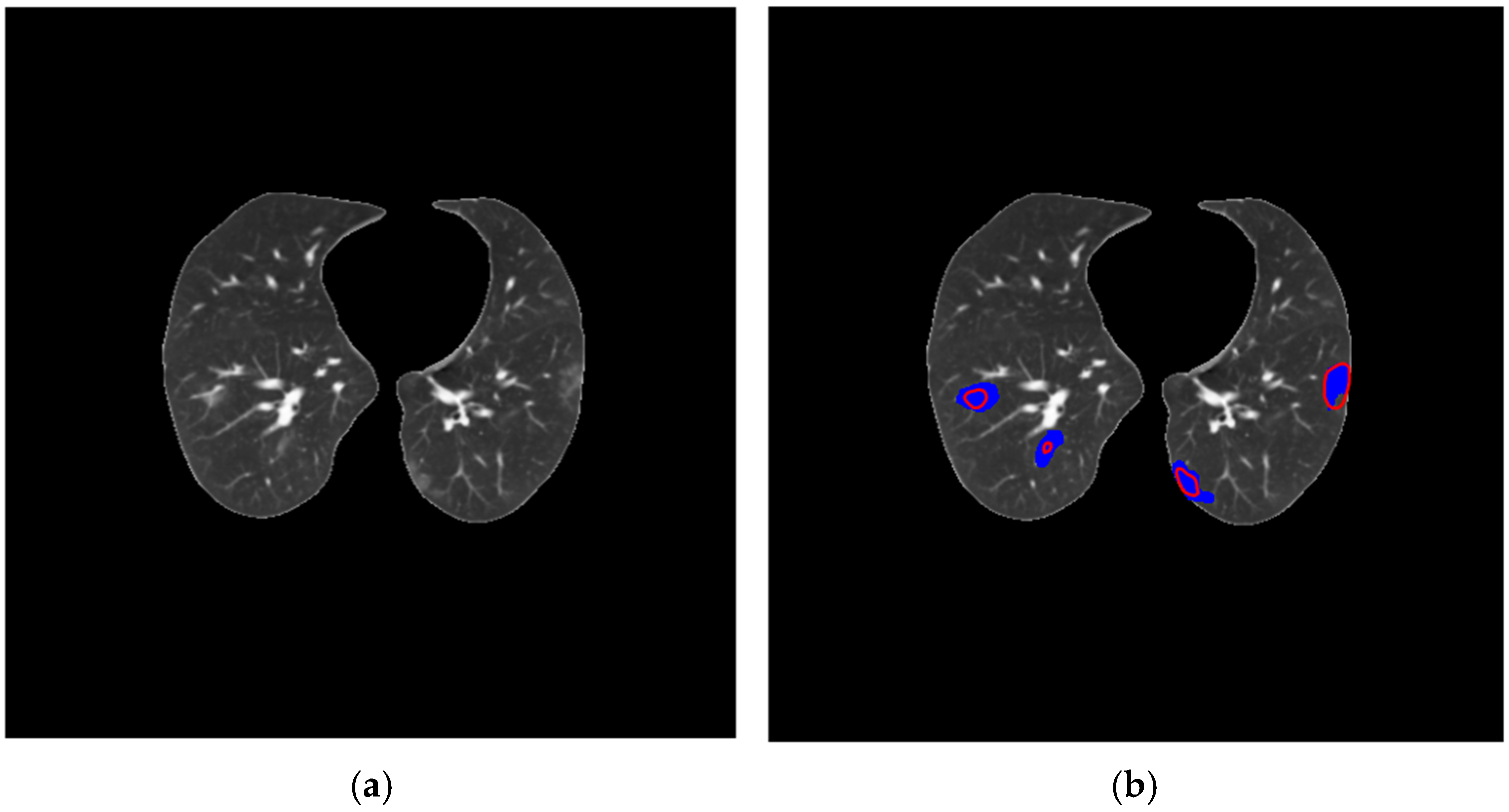 Diagnostics 14 02791 g012