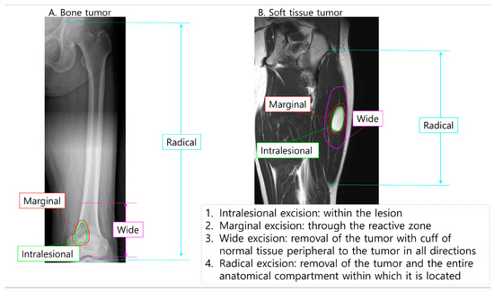裁断済 Soft Tissue and Bone Tumours Imaging of Premalignant