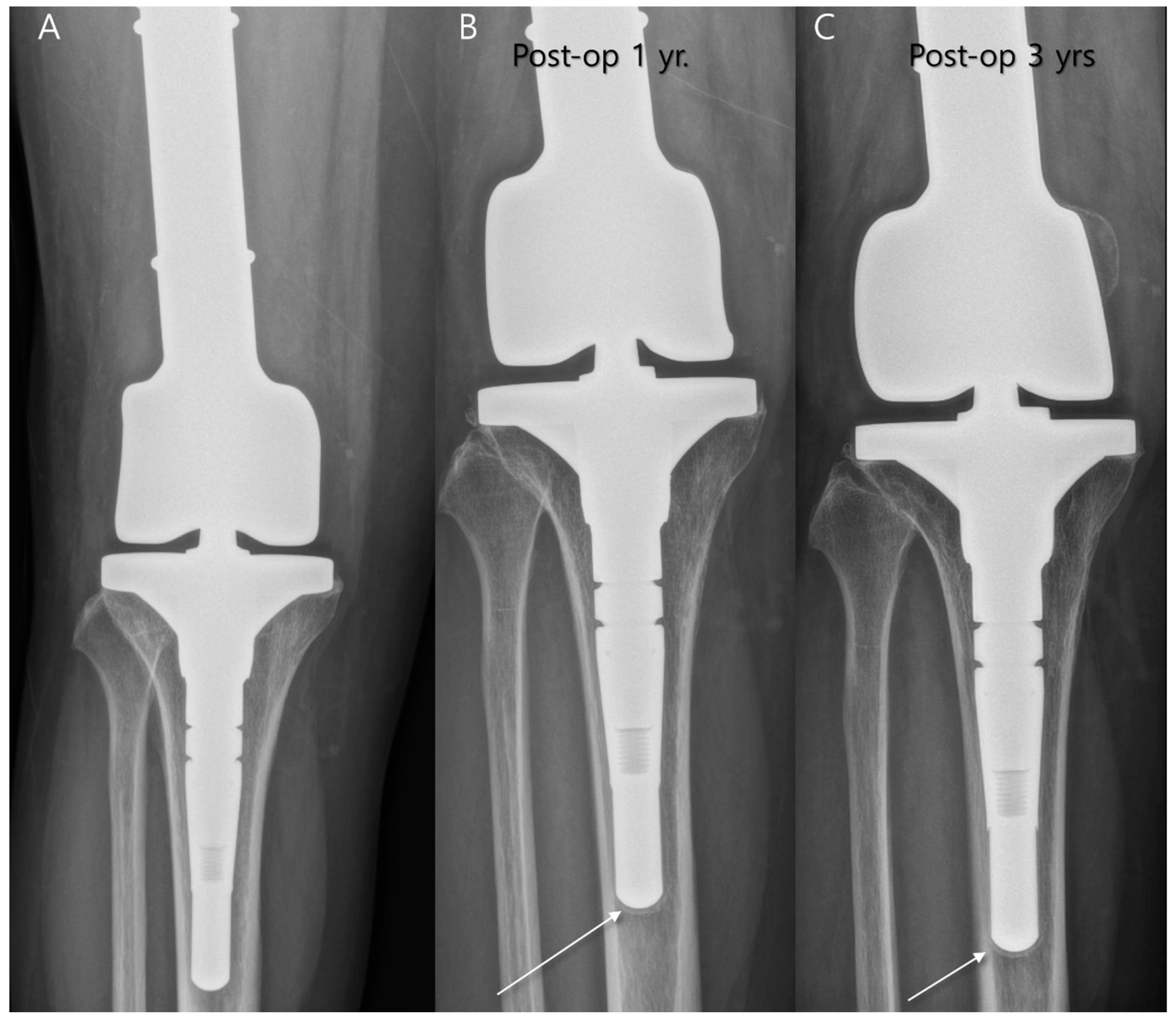 Diagnostics 14 02794 g005