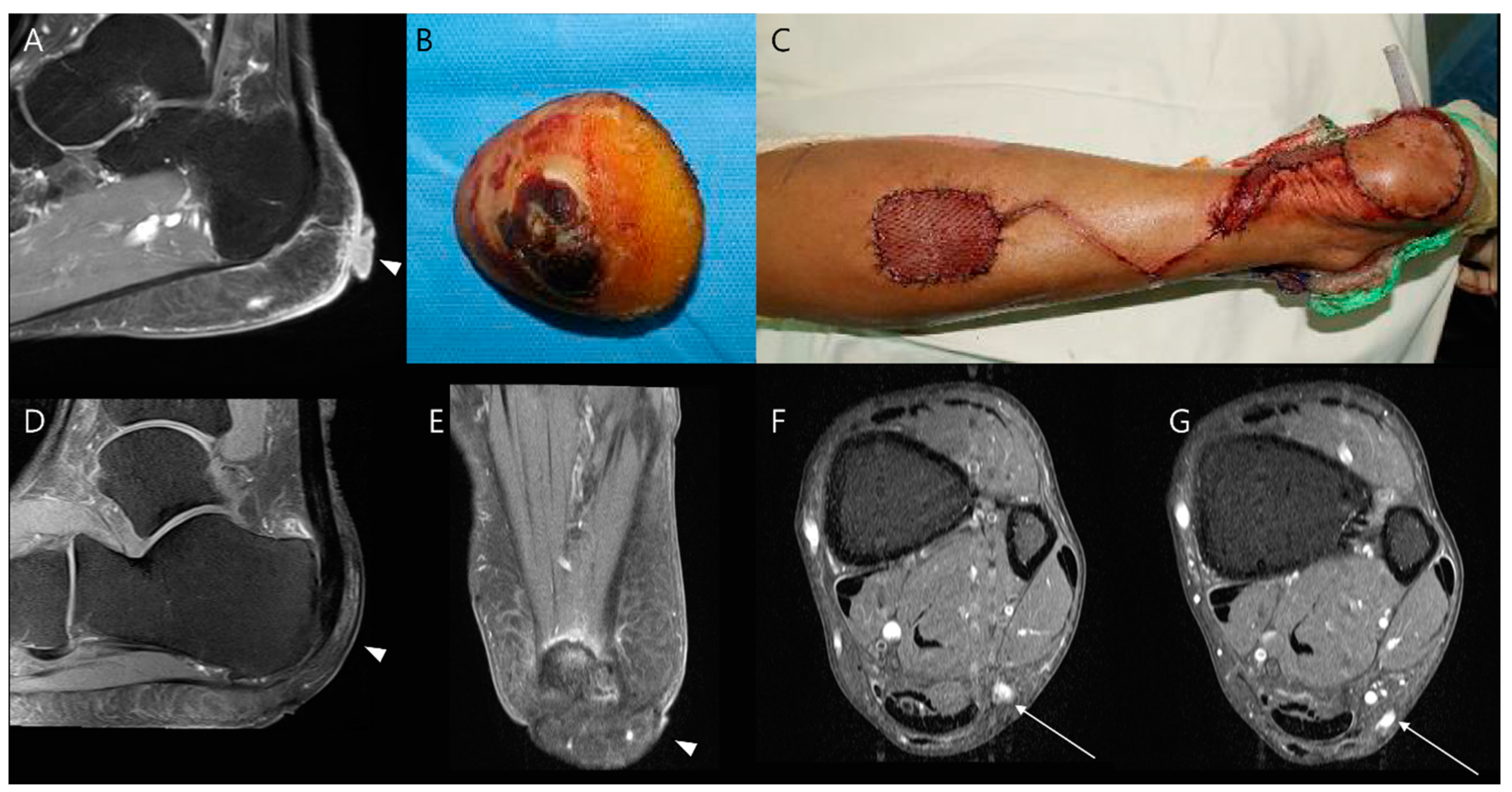 Diagnostics 14 02794 g007