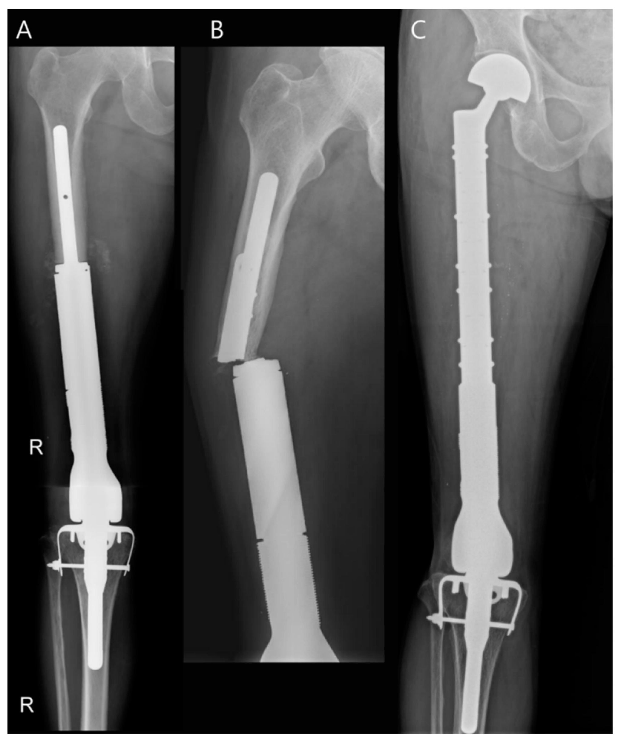 Diagnostics 14 02794 g011