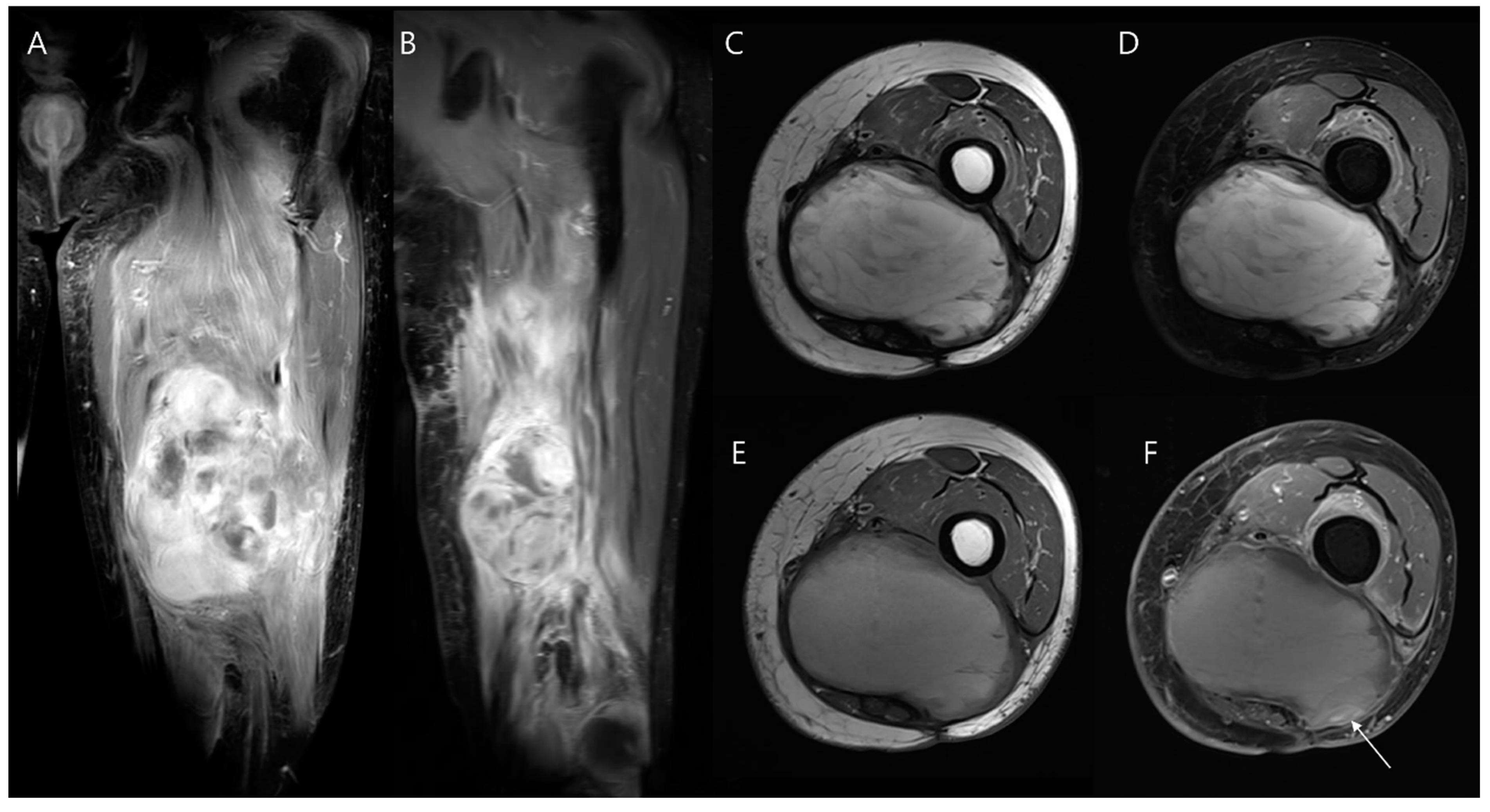 Diagnostics 14 02794 g013