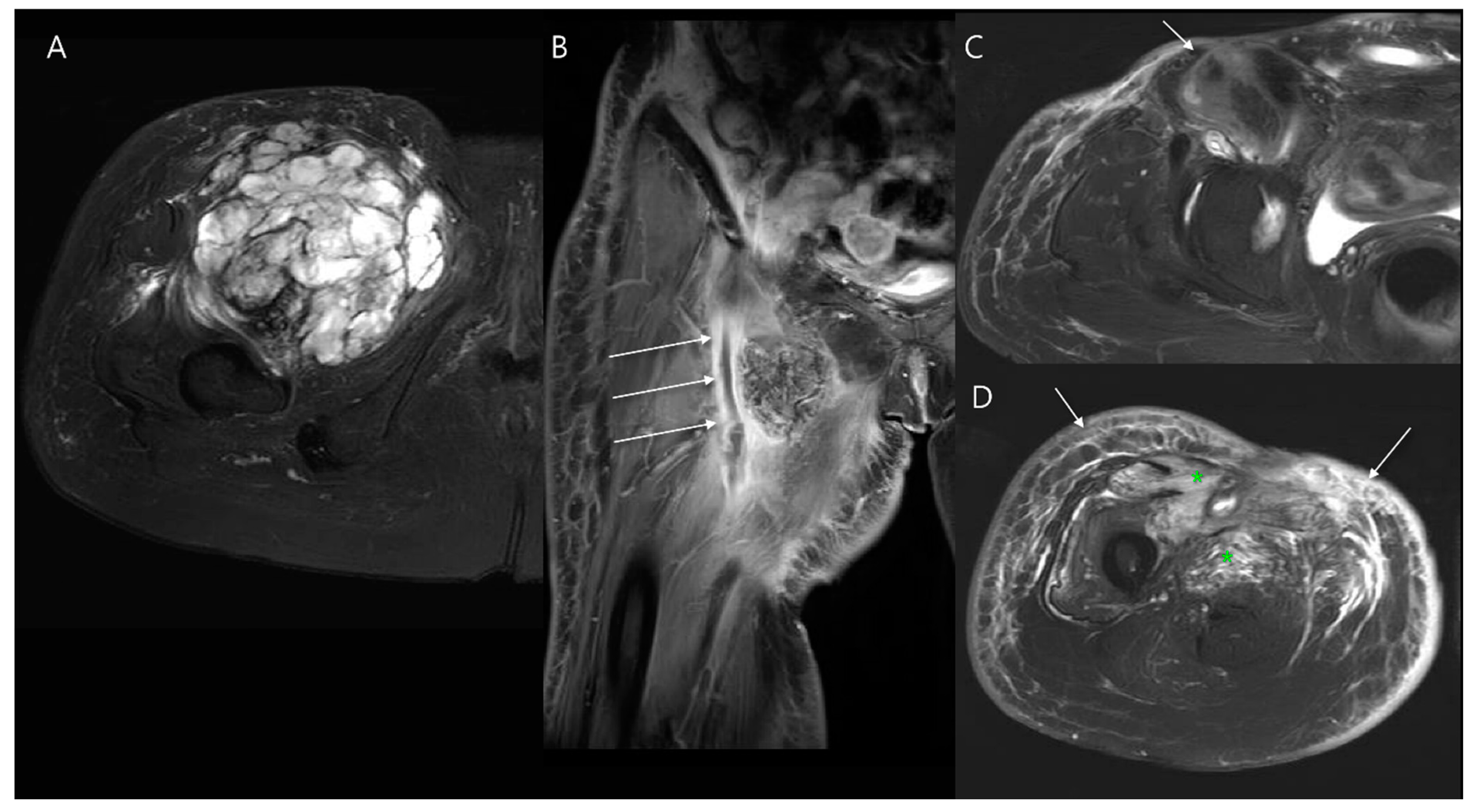 Diagnostics 14 02794 g014