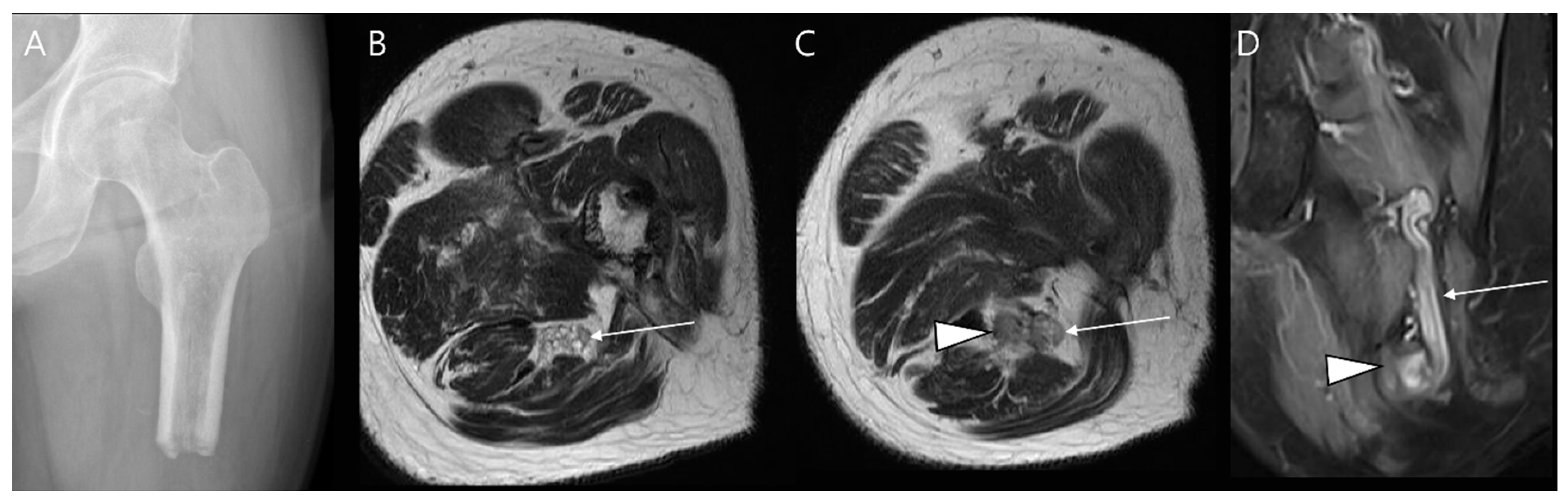 Diagnostics 14 02794 g016