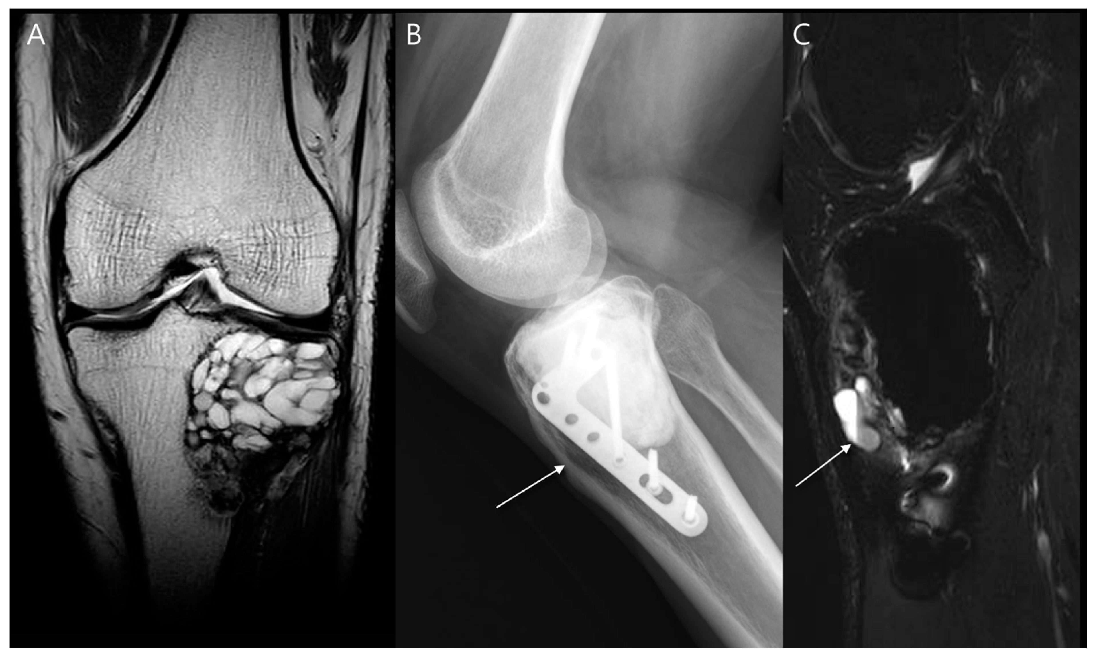 Diagnostics 14 02794 g018