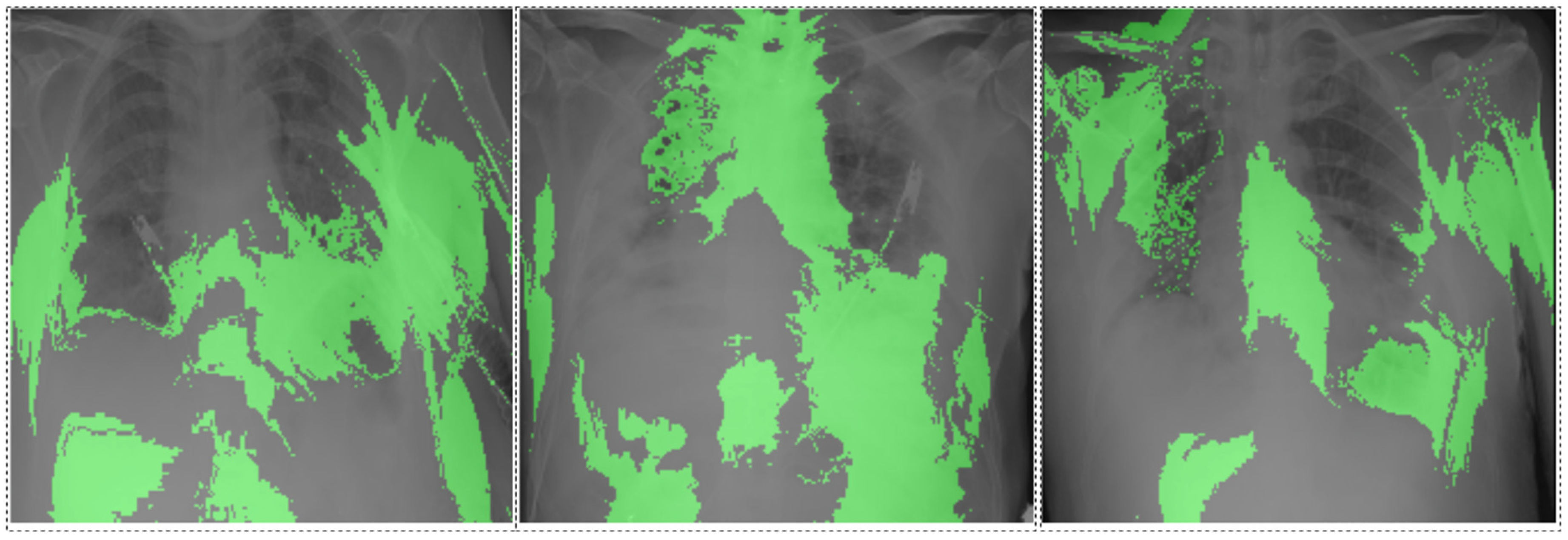 Diagnostics 14 02800 g005