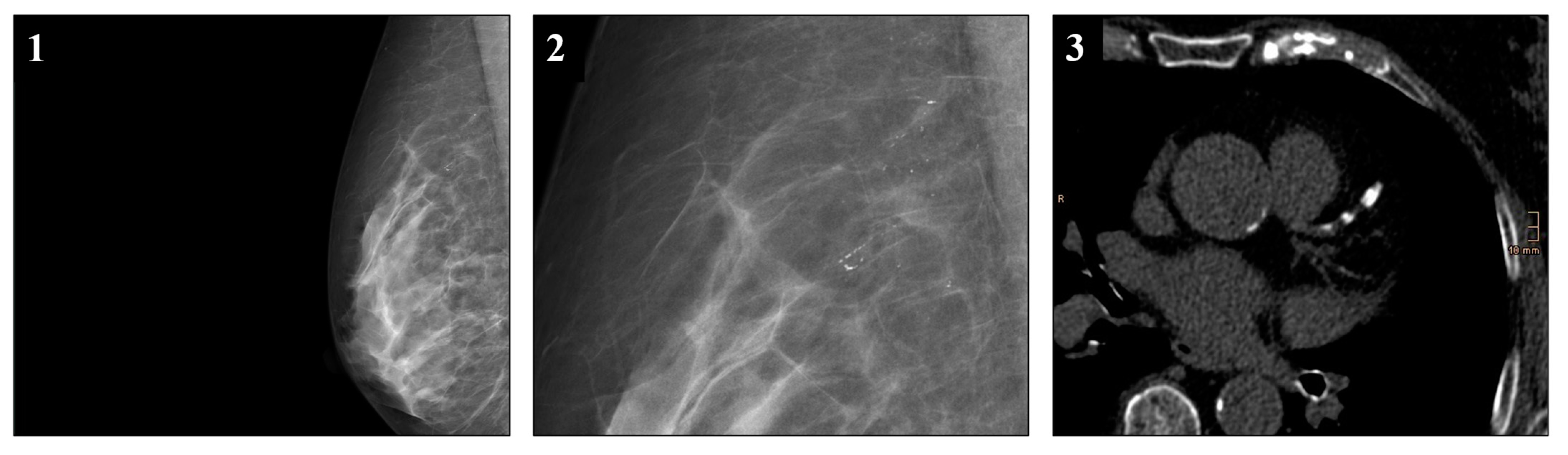 Diagnostics 14 02803 g003