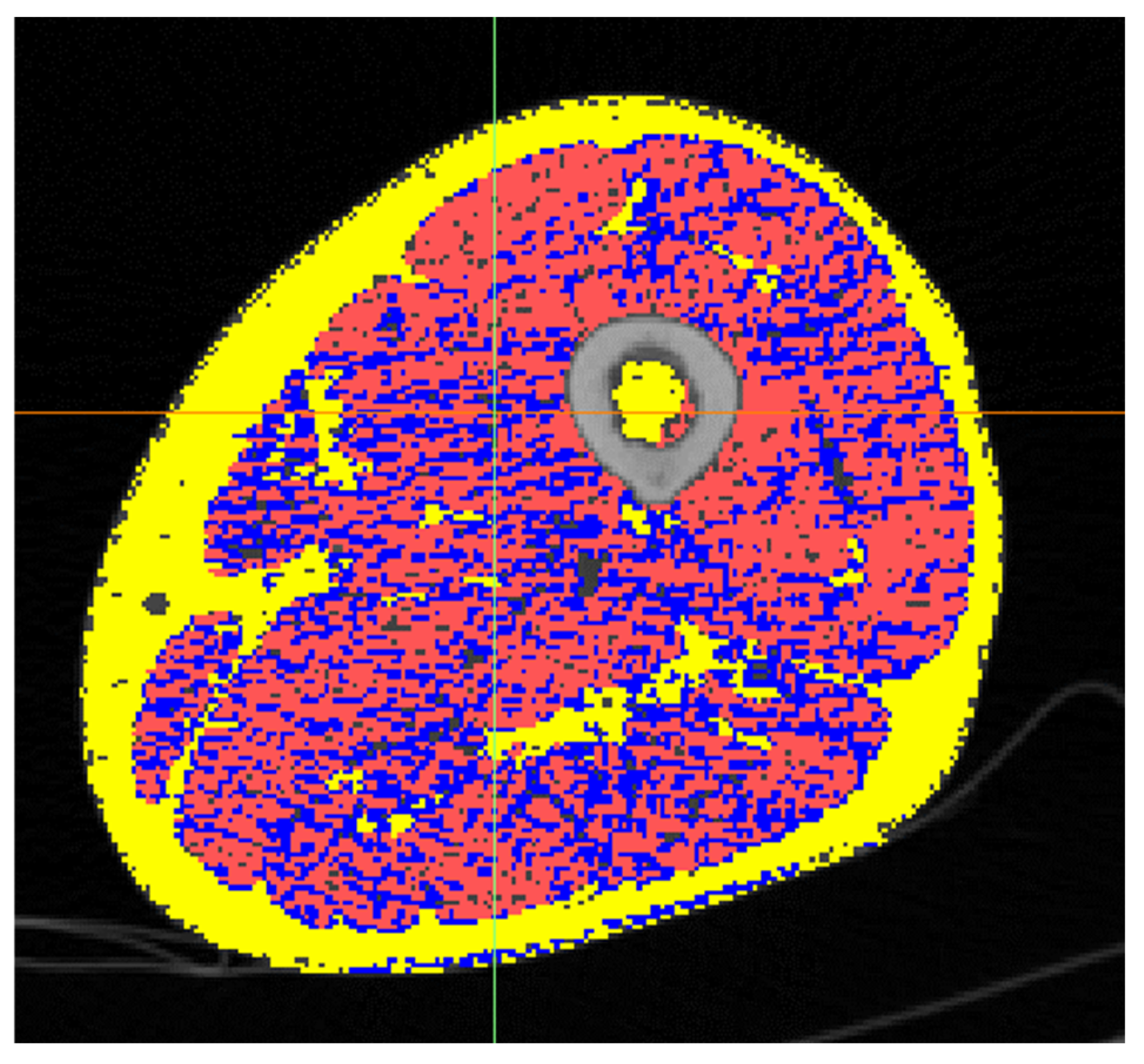 Diagnostics 14 02808 g003 Diagnostics 14 02808 g003