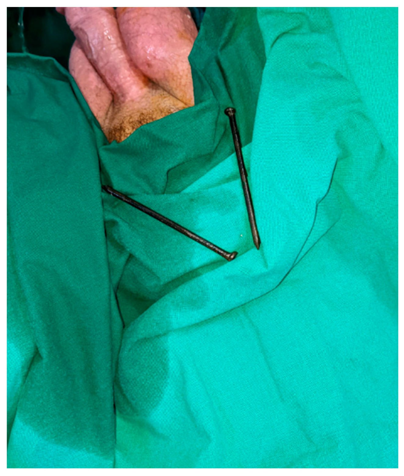 Diagnostics 14 02825 g001 Diagnostics 14 02825 g001