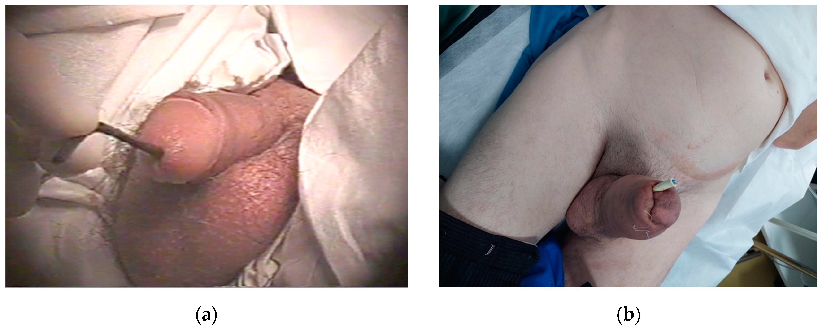 Diagnostics 14 02825 g002 Diagnostics 14 02825 g002