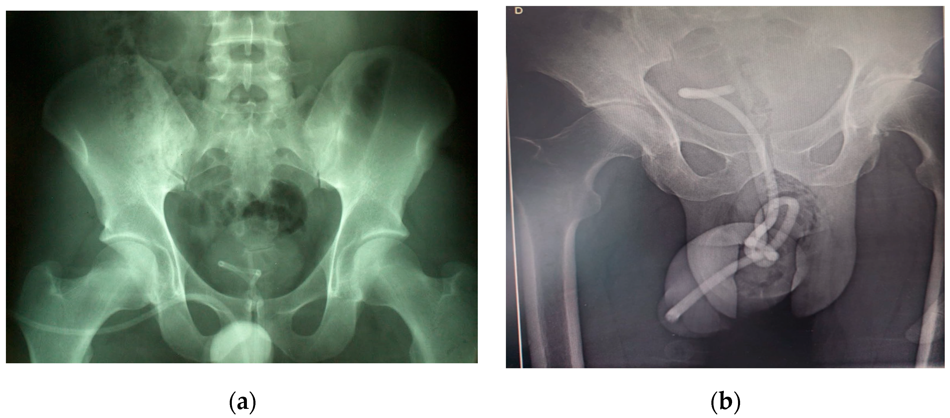 Diagnostics 14 02825 g003 Diagnostics 14 02825 g003