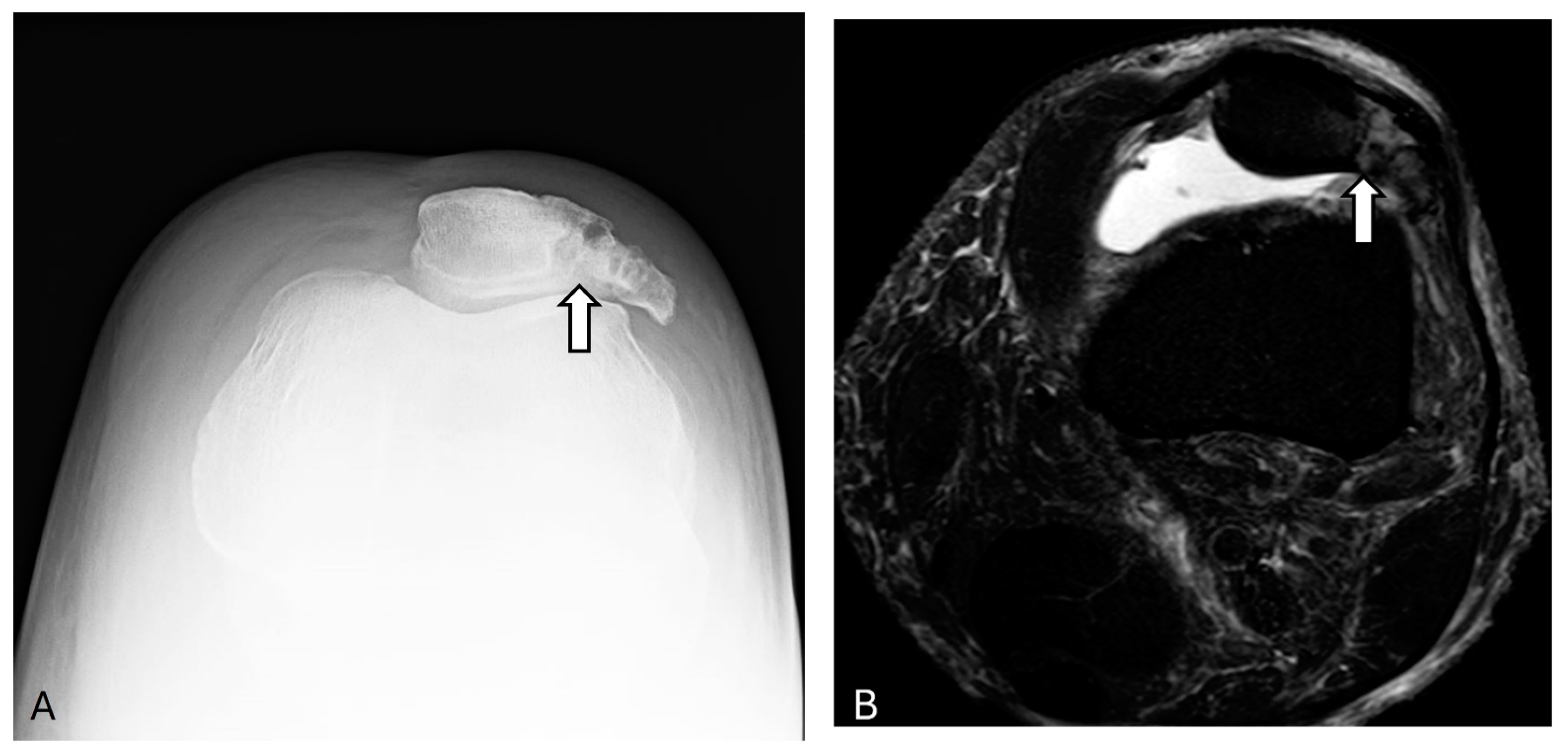 Diagnostics 14 02828 g003 Diagnostics 14 02828 g003