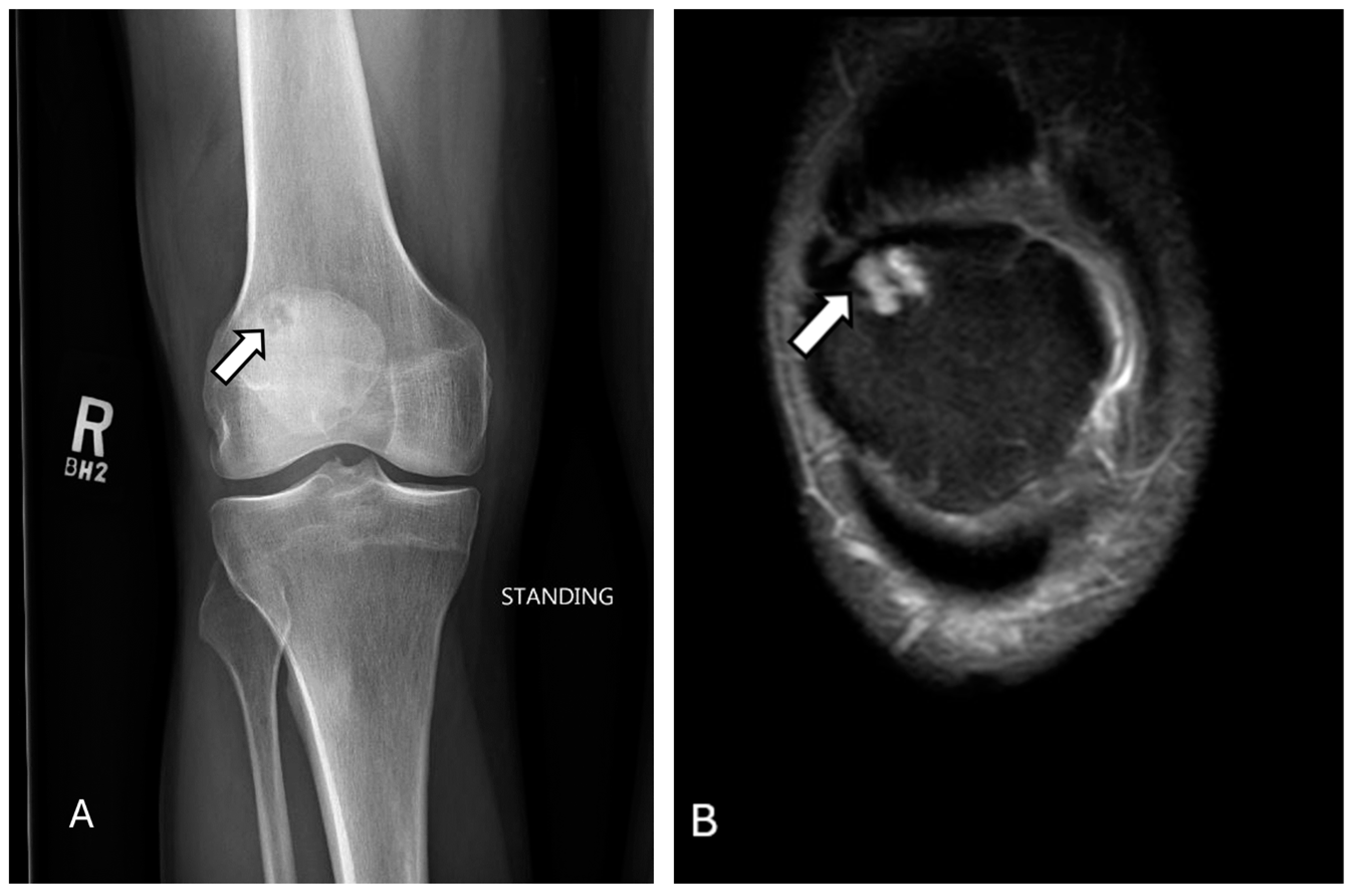 Diagnostics 14 02828 g004 Diagnostics 14 02828 g004