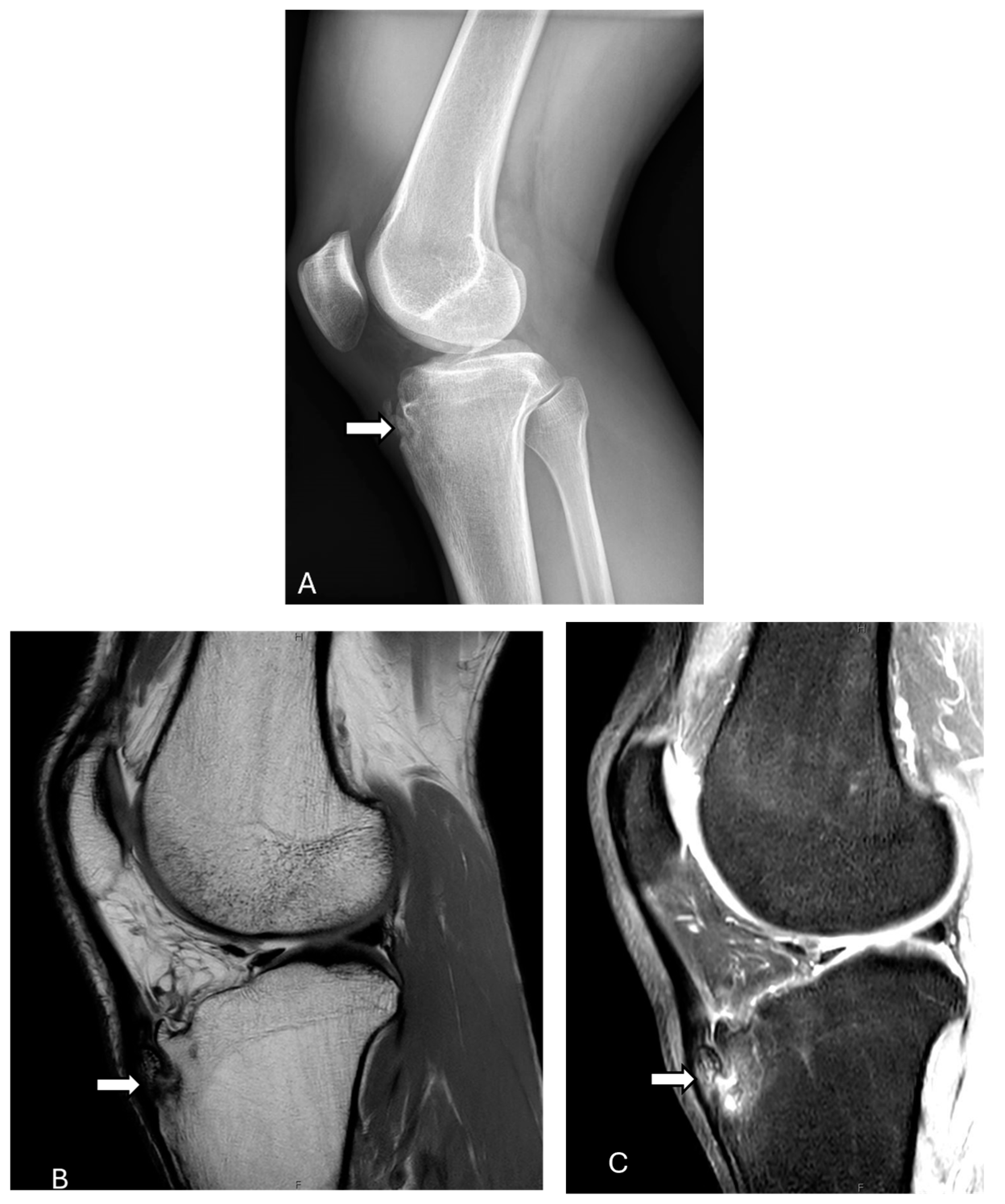 Diagnostics 14 02828 g006 Diagnostics 14 02828 g006